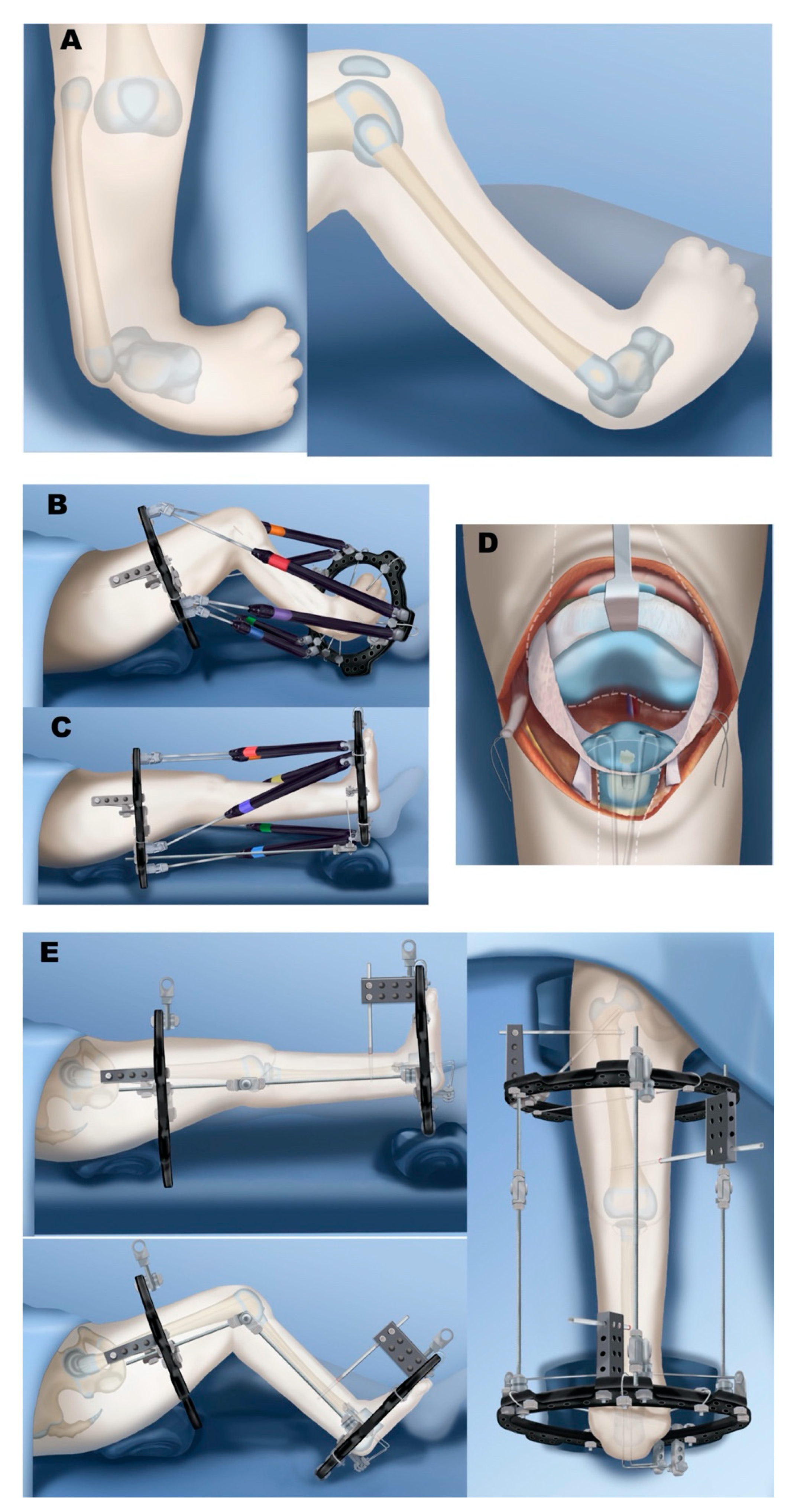 Children 08 00461 g010