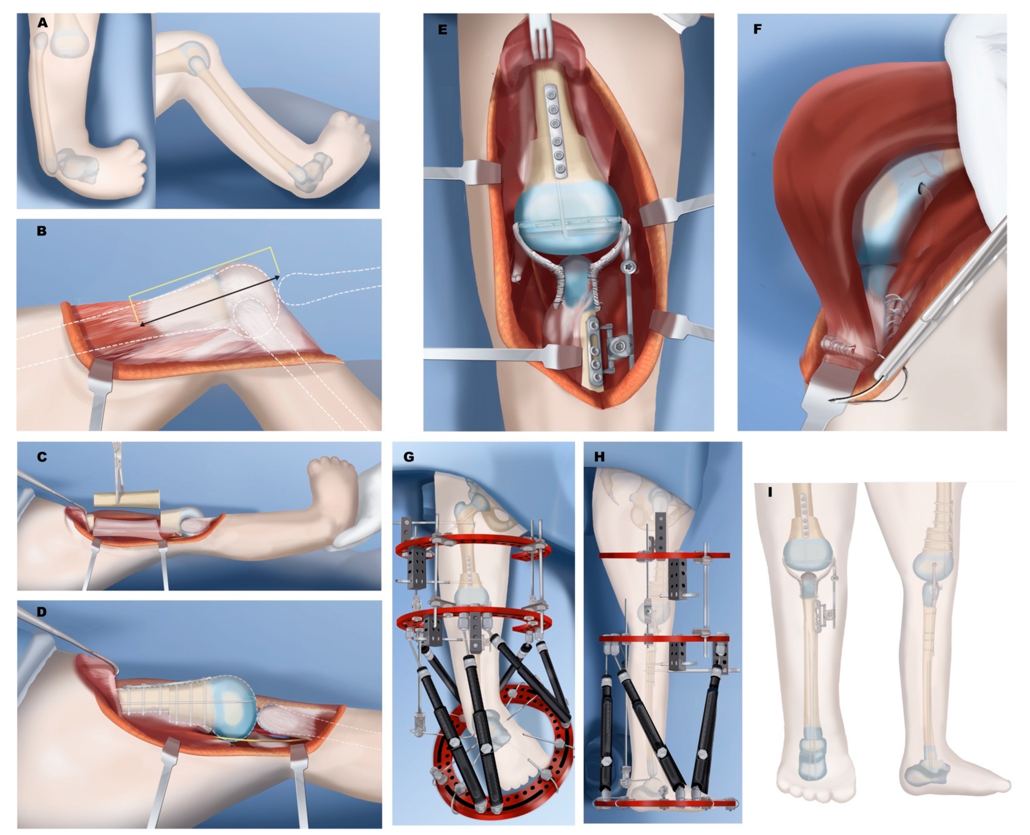 Children 08 00461 g011