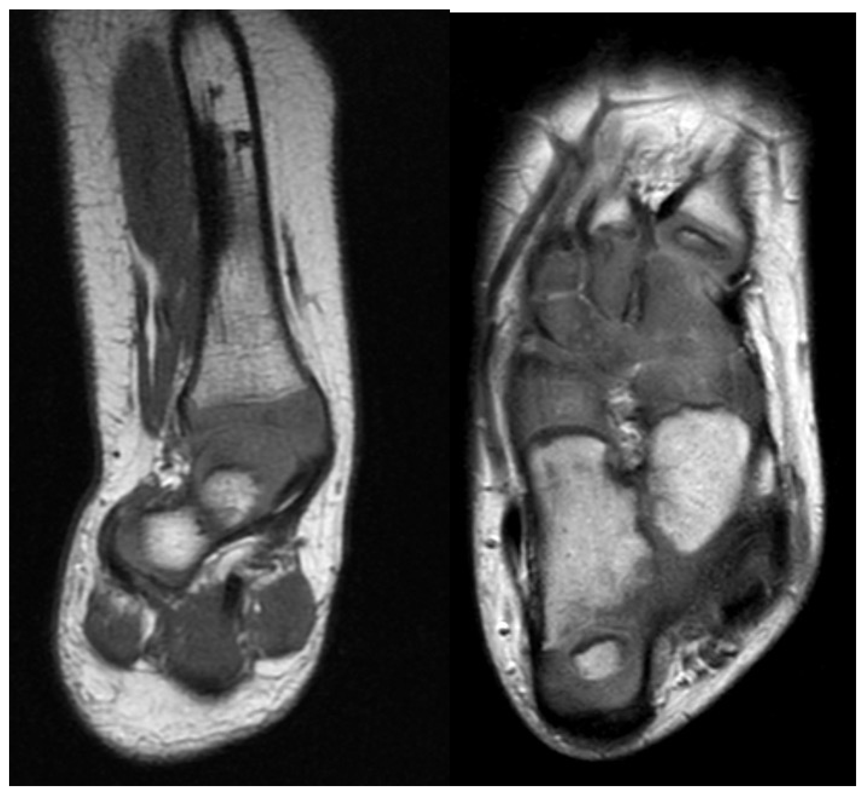 Children 08 00467 g002