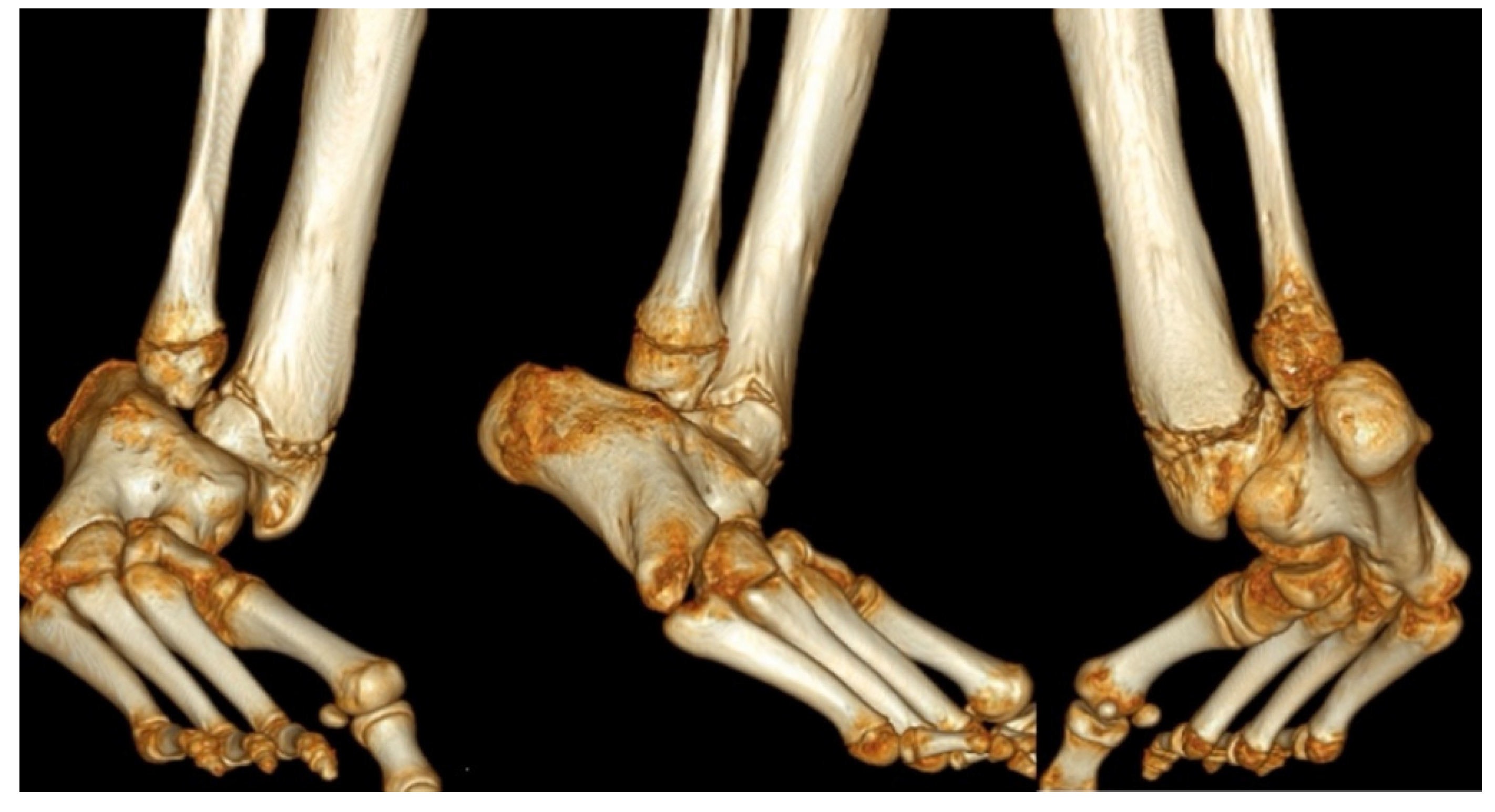 Children 08 00467 g003