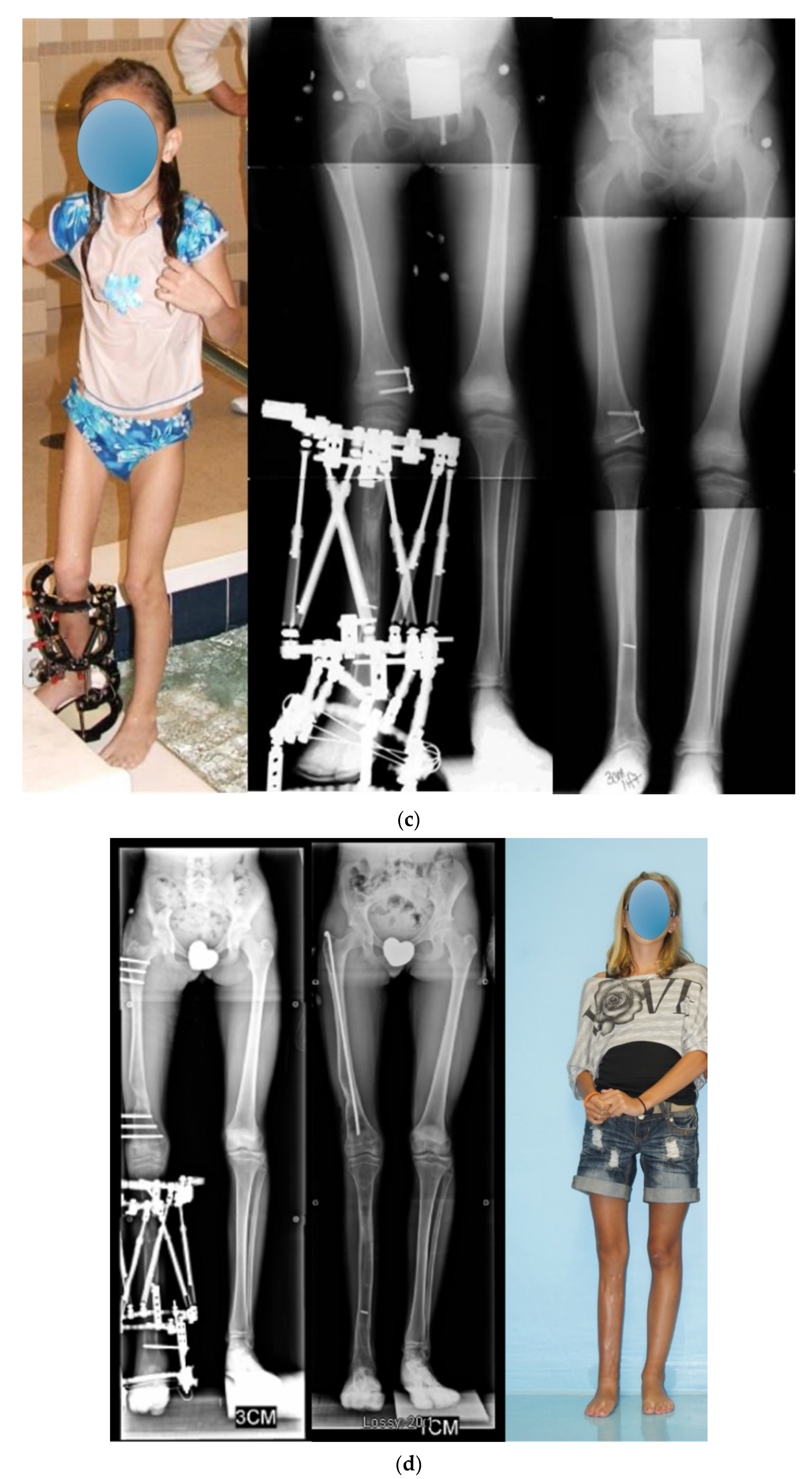 Children 08 00467 g006b