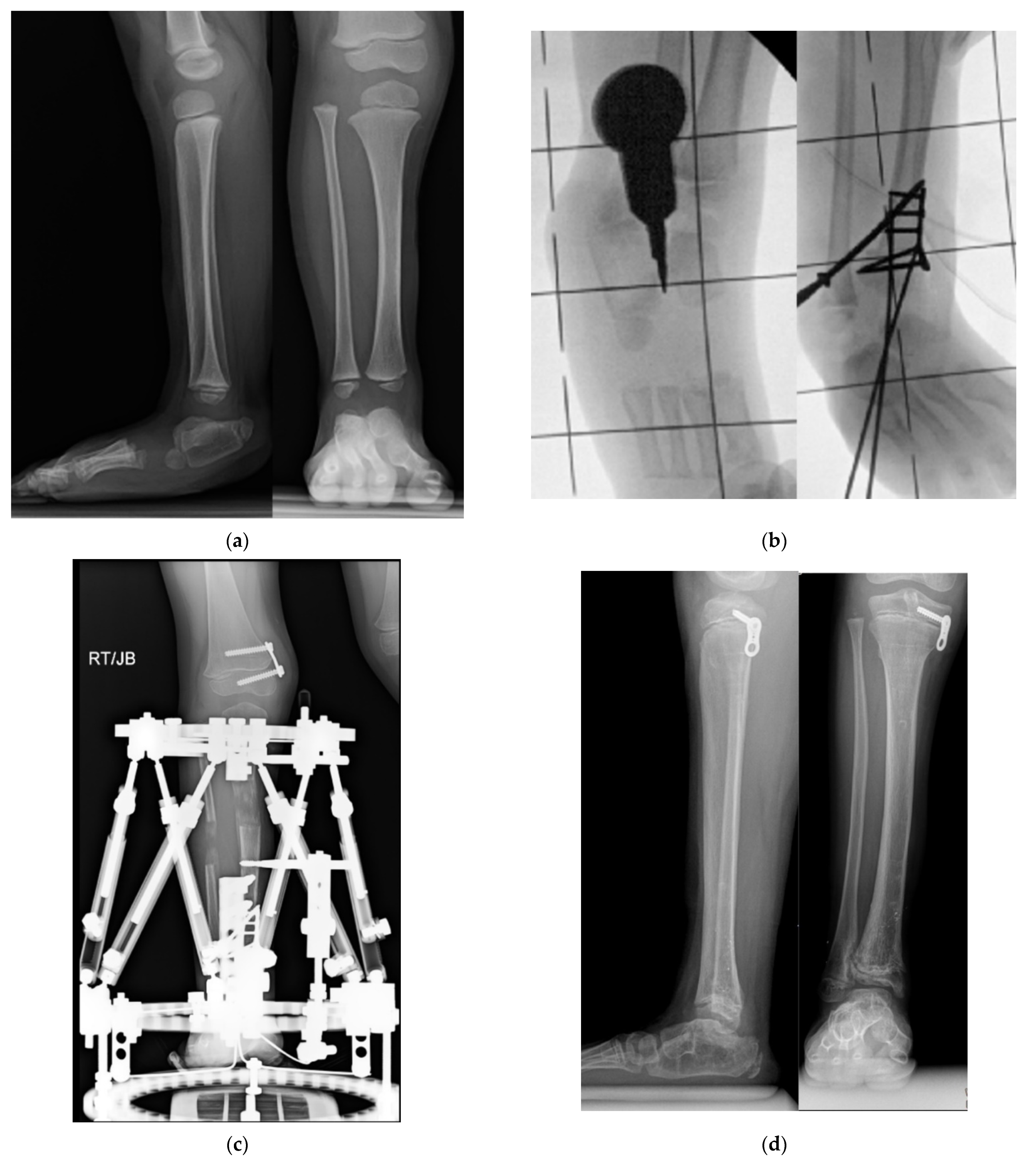 Children 08 00467 g007a