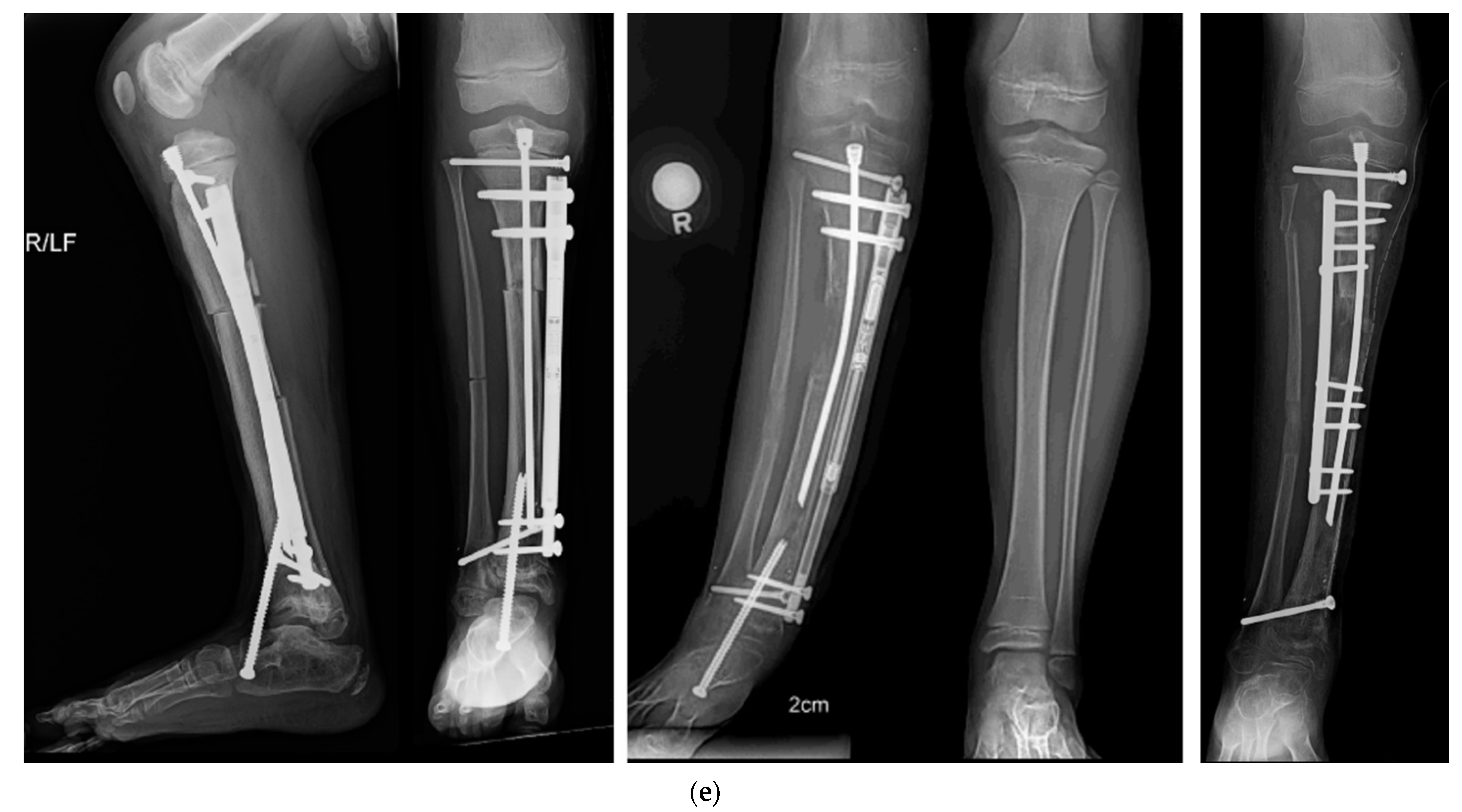 Children 08 00467 g007b