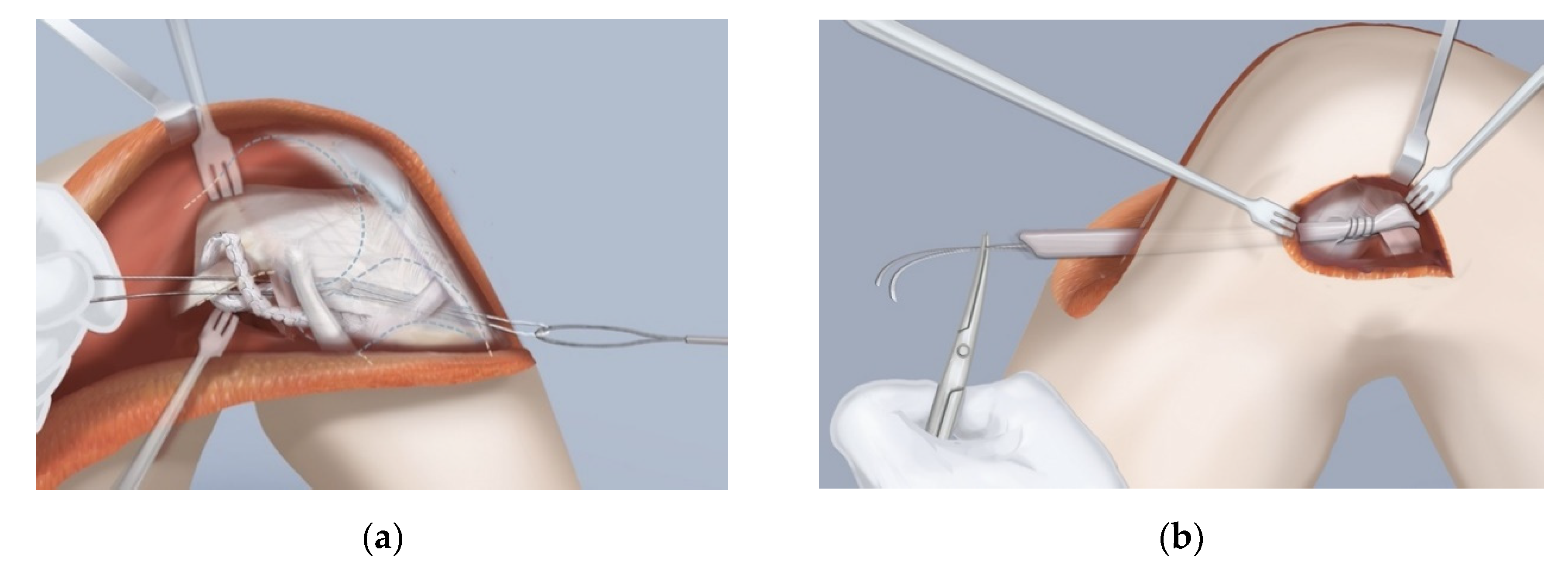 Children 08 00467 g008