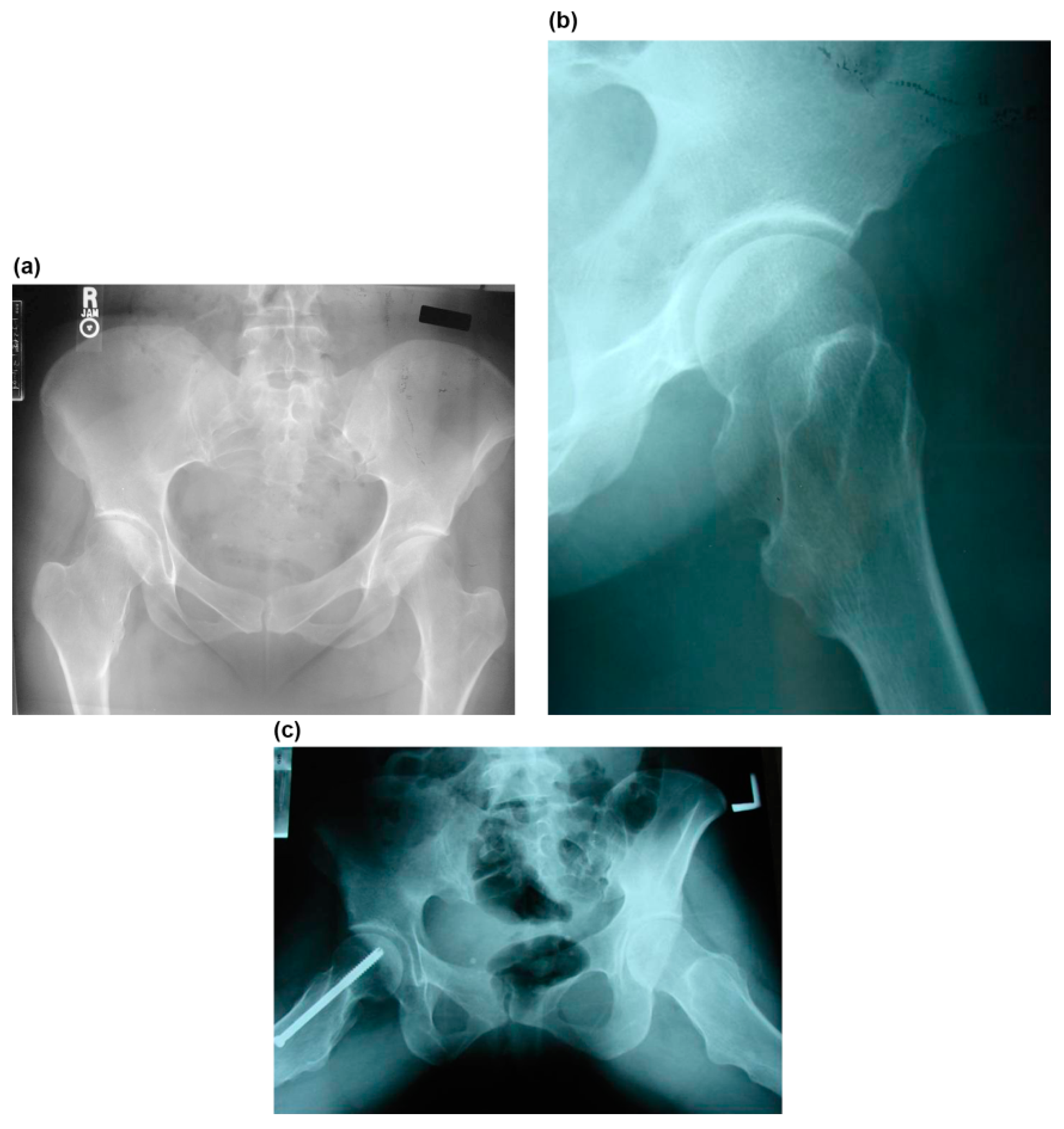 Children 08 00490 g001