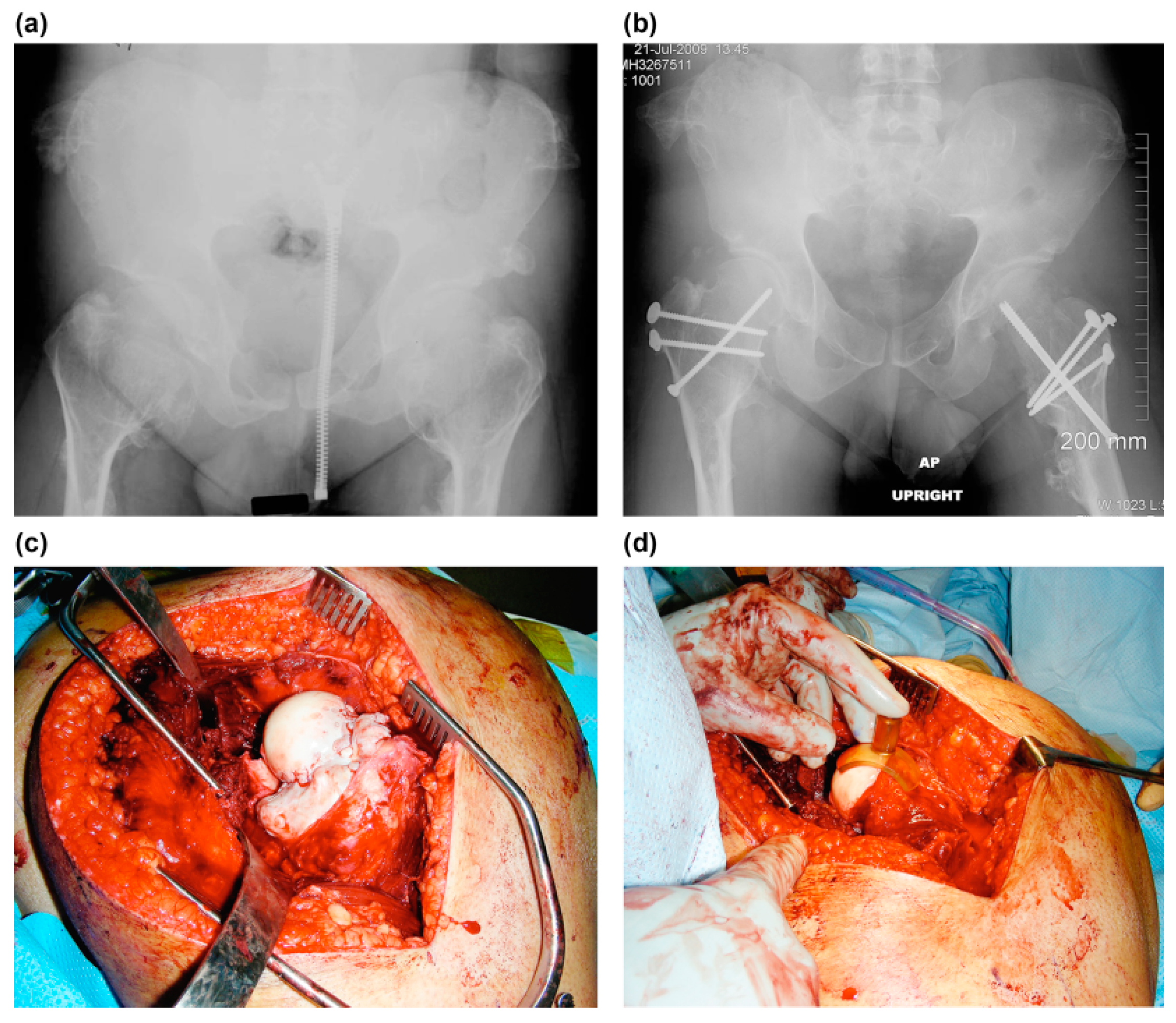 Children 08 00490 g003