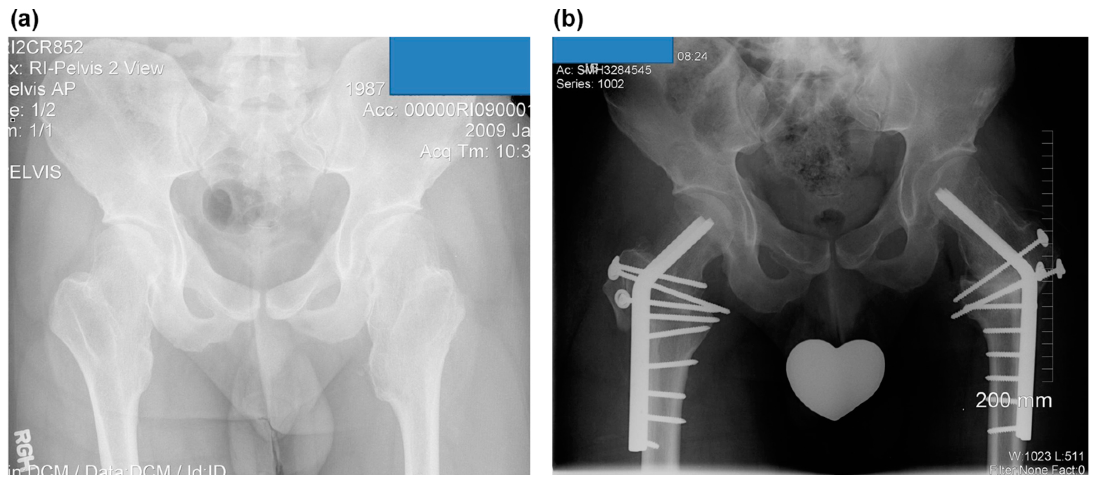 Children 08 00490 g004