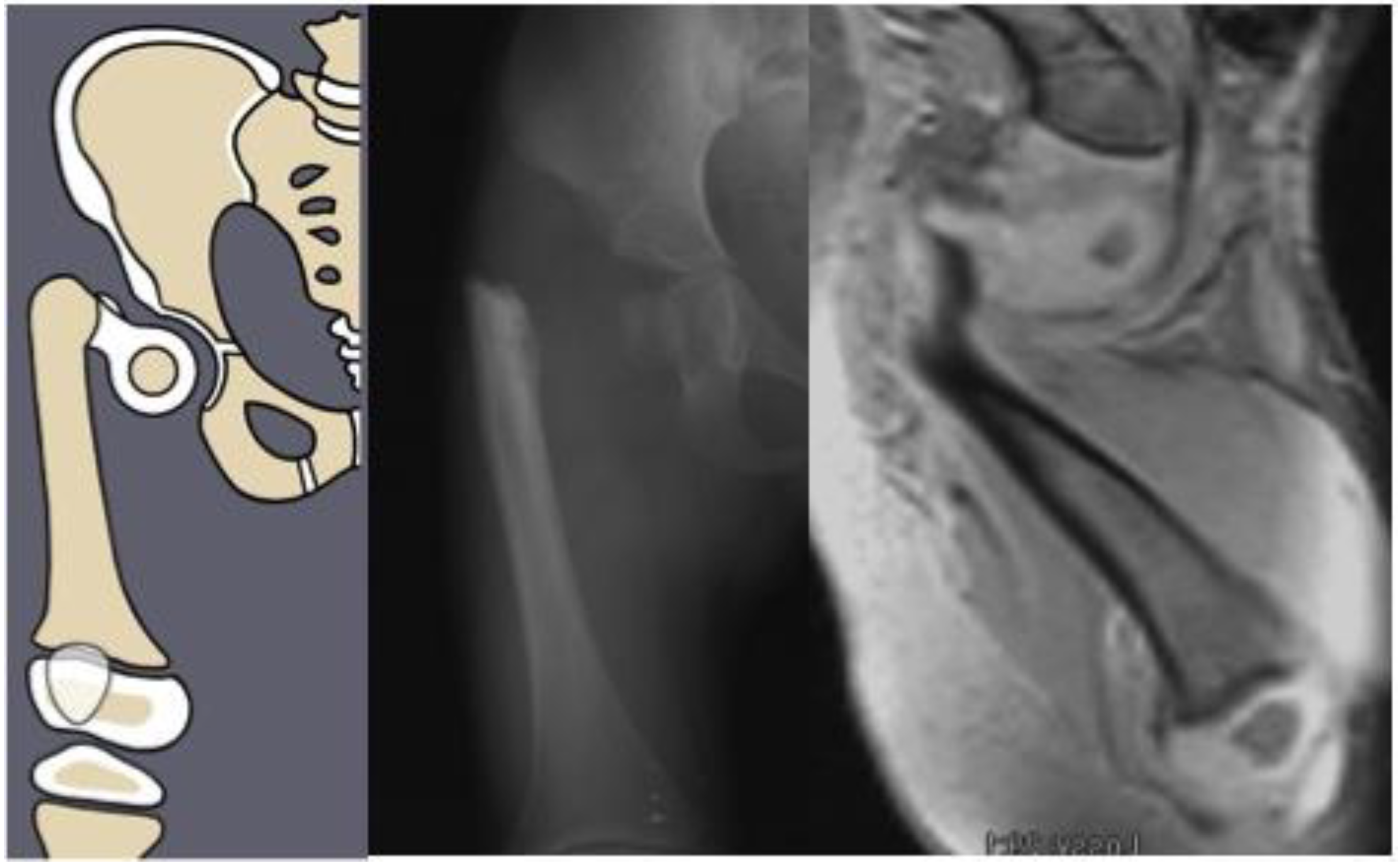 Children 08 00495 g002 Children 08 00495 g002