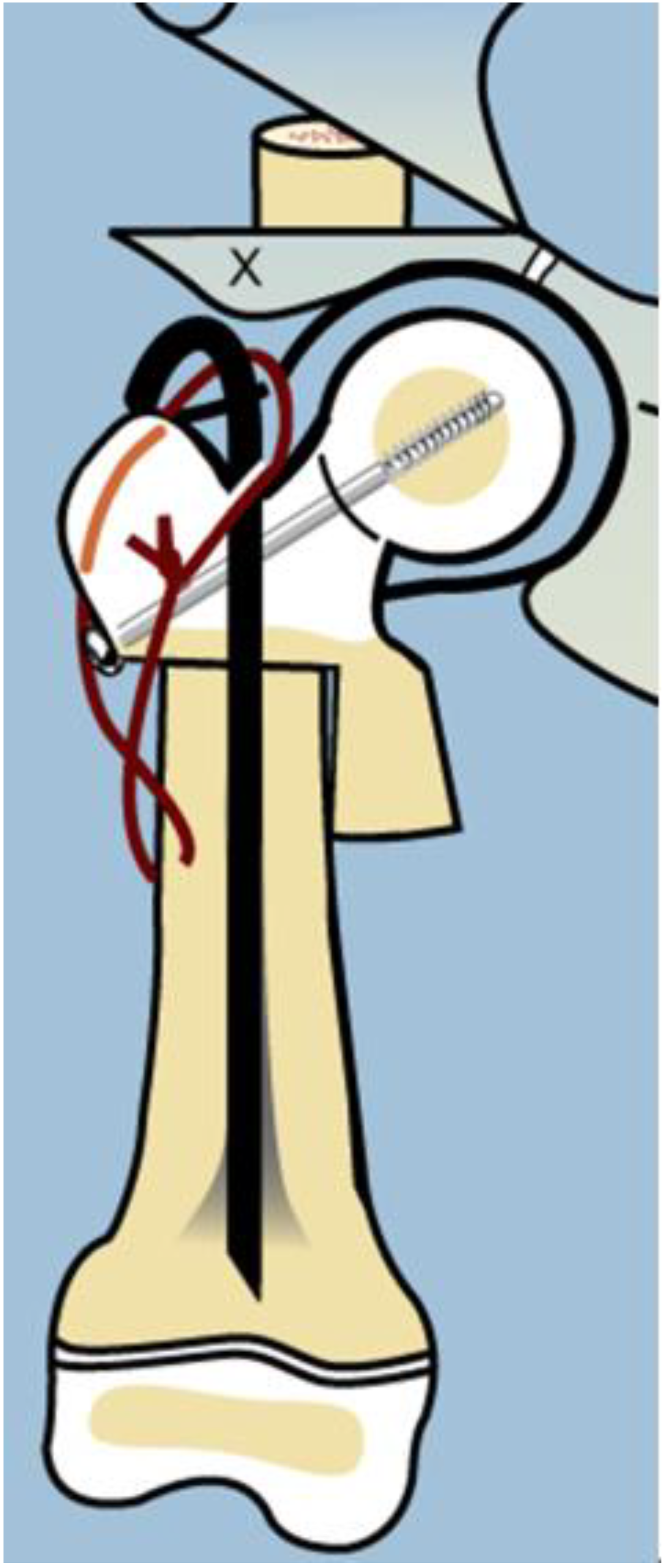 Children 08 00495 g003 Children 08 00495 g003