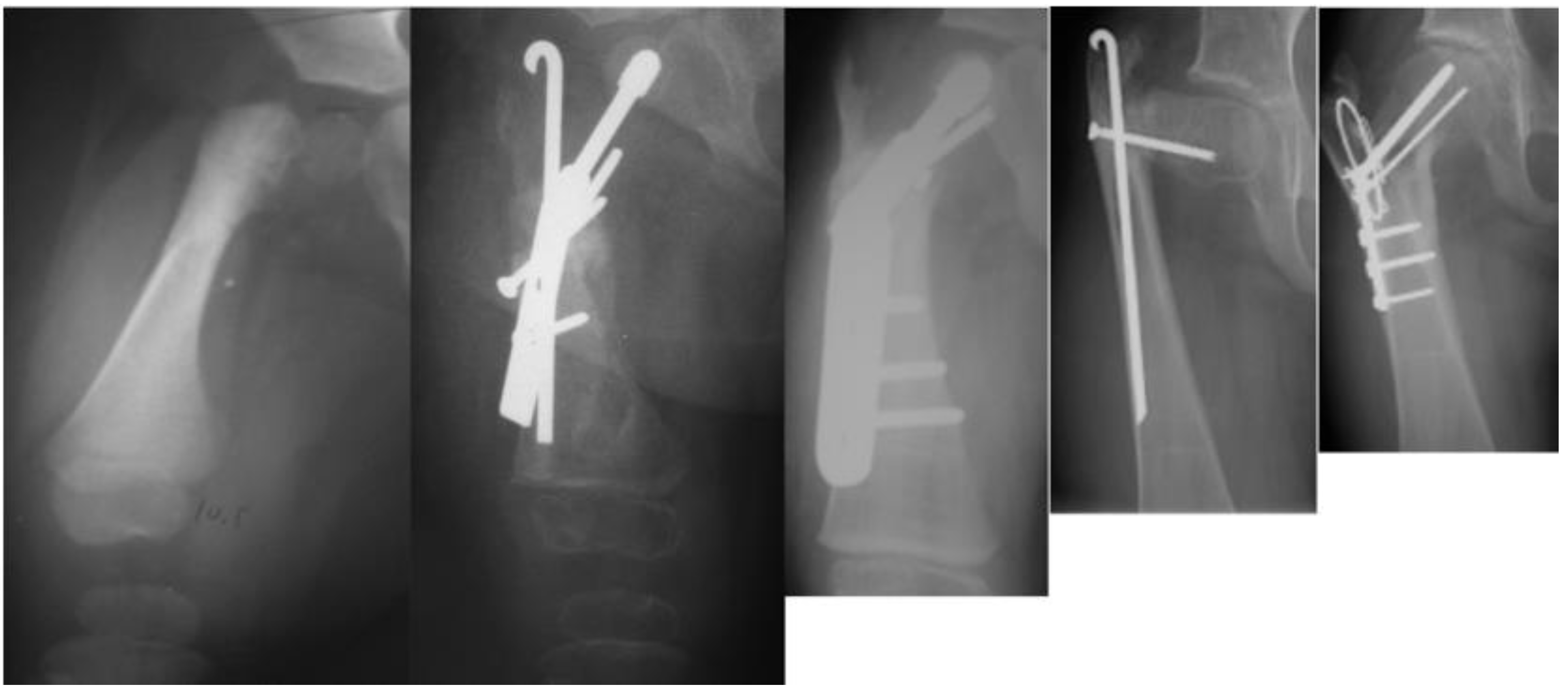 Children 08 00495 g005 Children 08 00495 g005