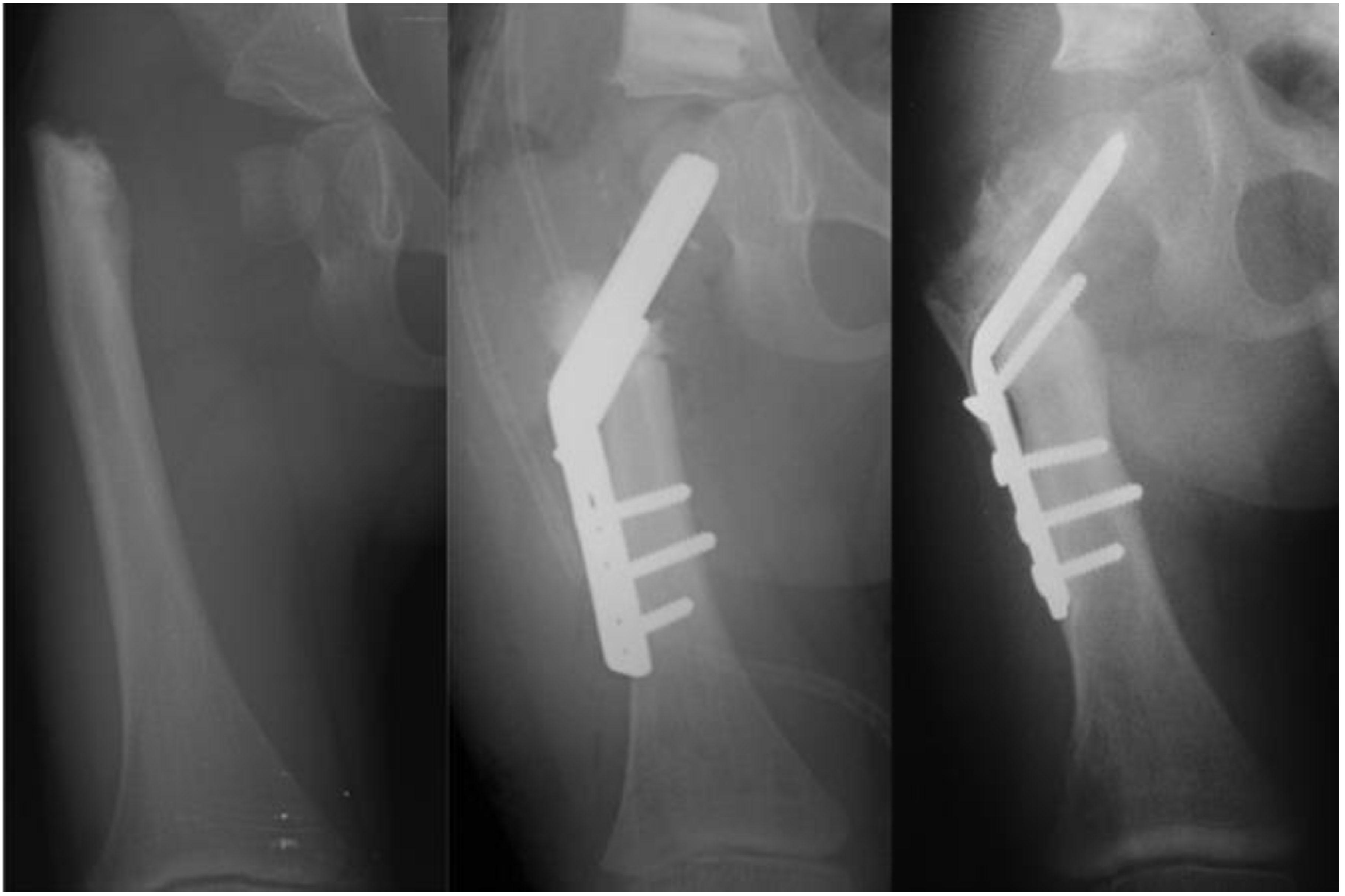 Children 08 00495 g006 Children 08 00495 g006