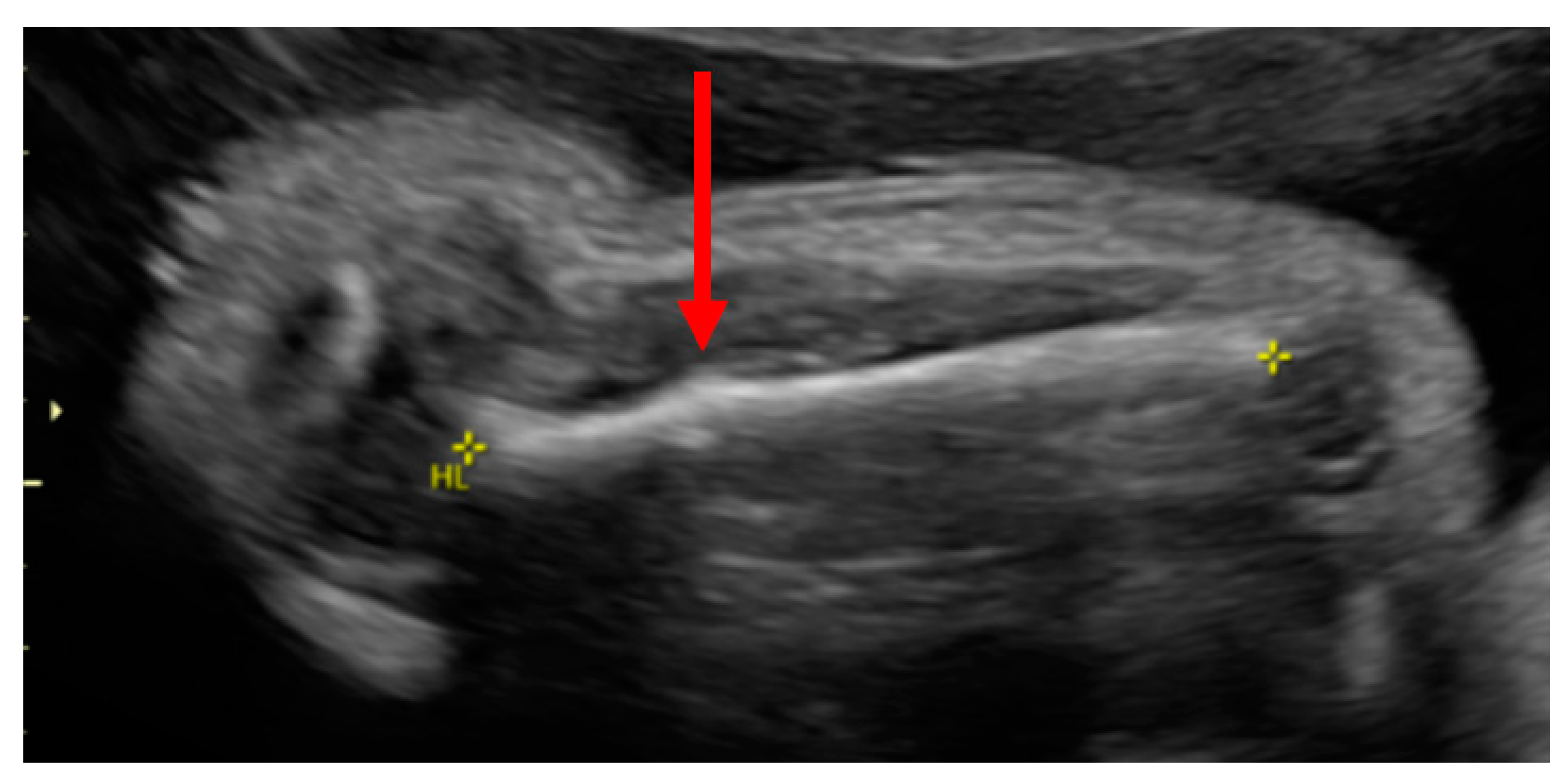 Children 08 00512 g001