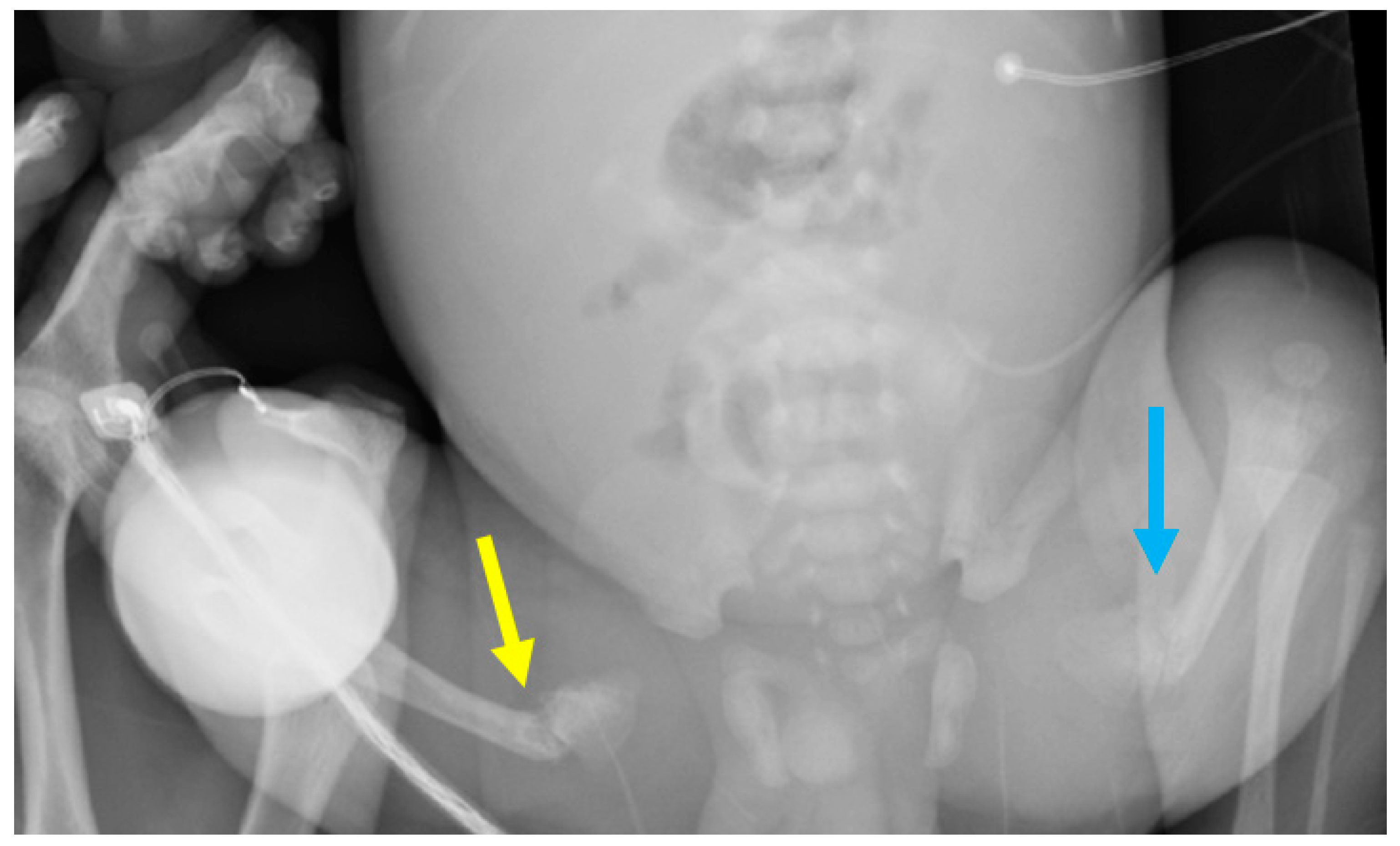 Children 08 00512 g005