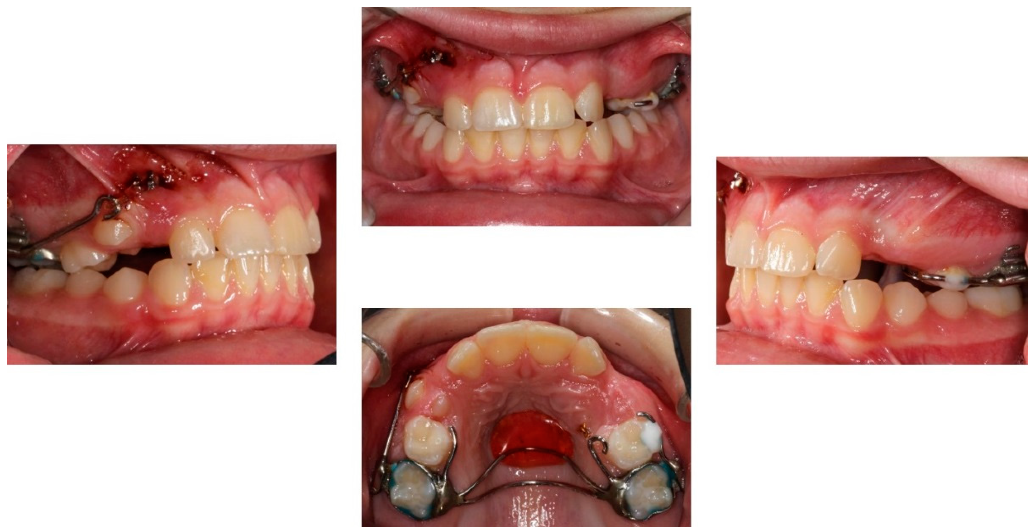 Children 08 00519 g007 Children 08 00519 g007