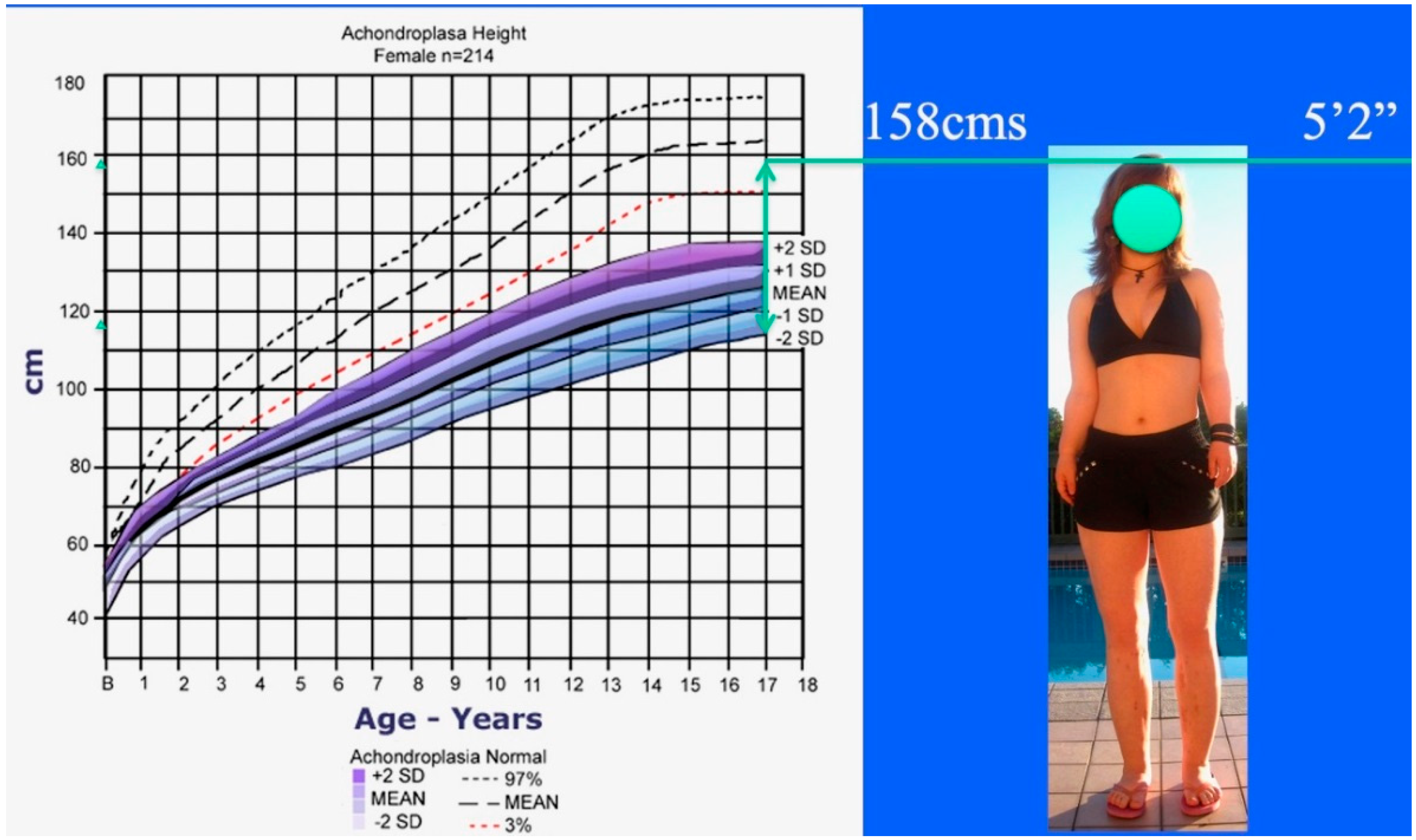 Children 08 00540 g005