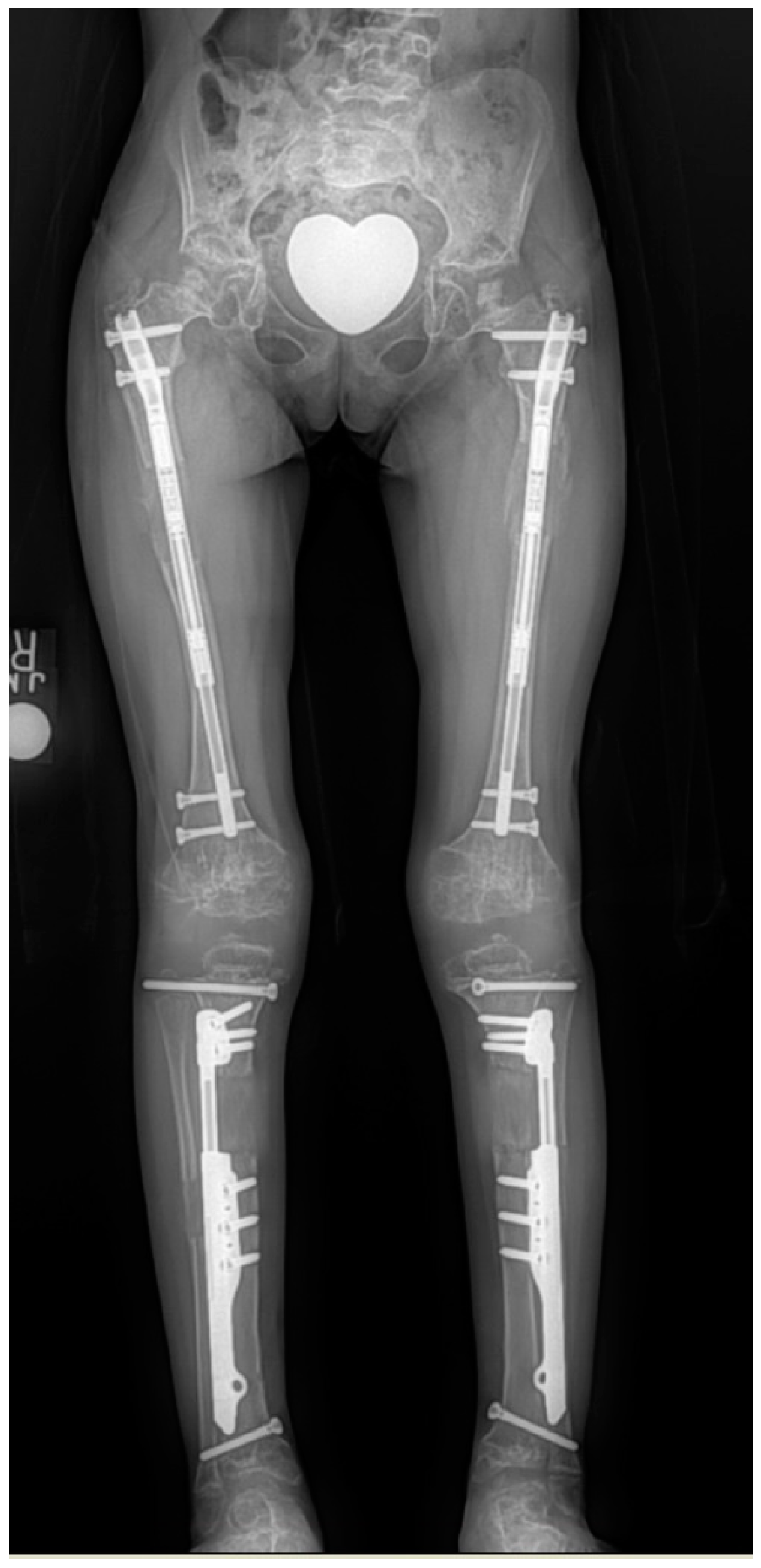 Children 08 00540 g009