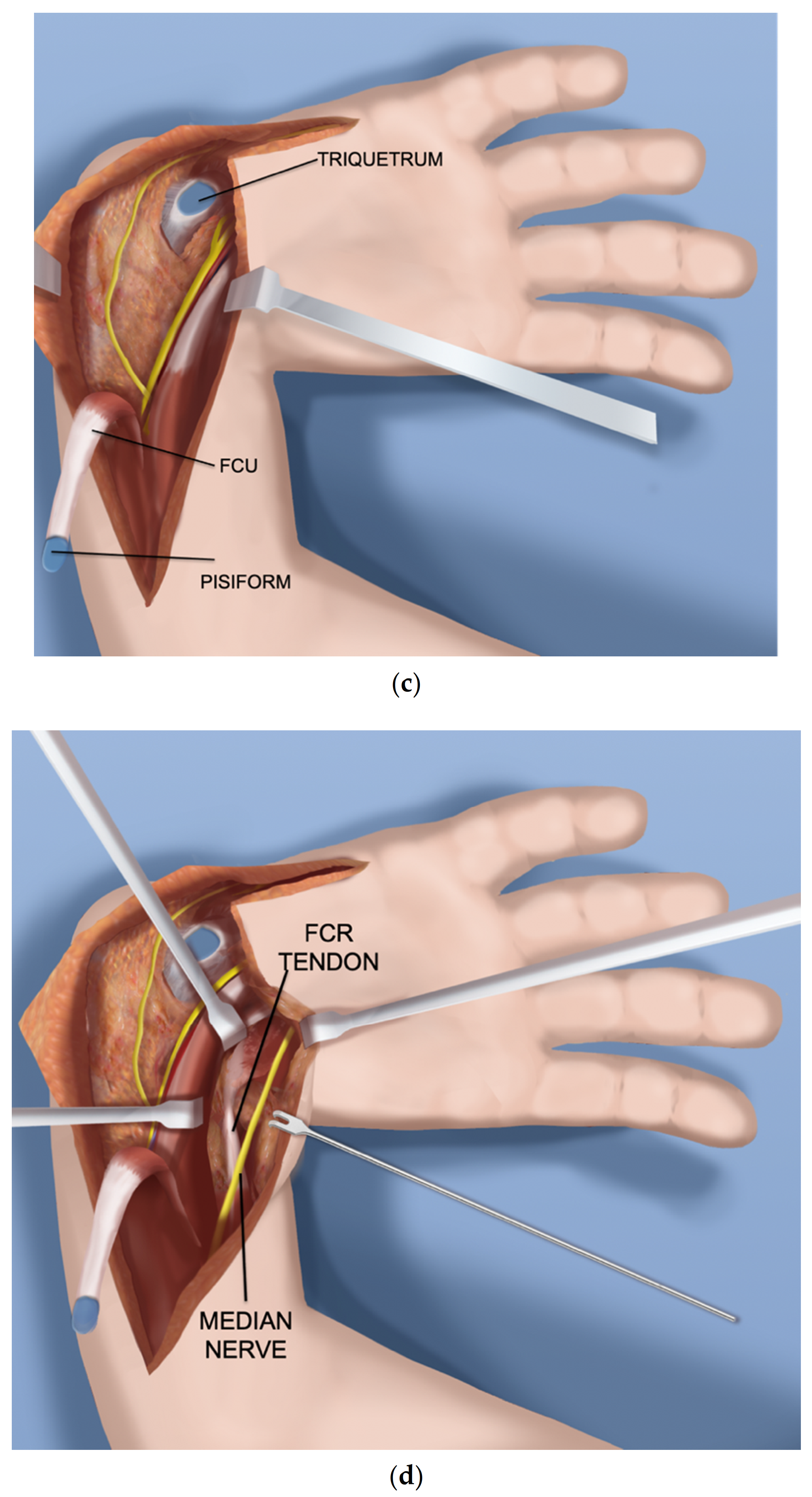 Children 08 00562 g001b