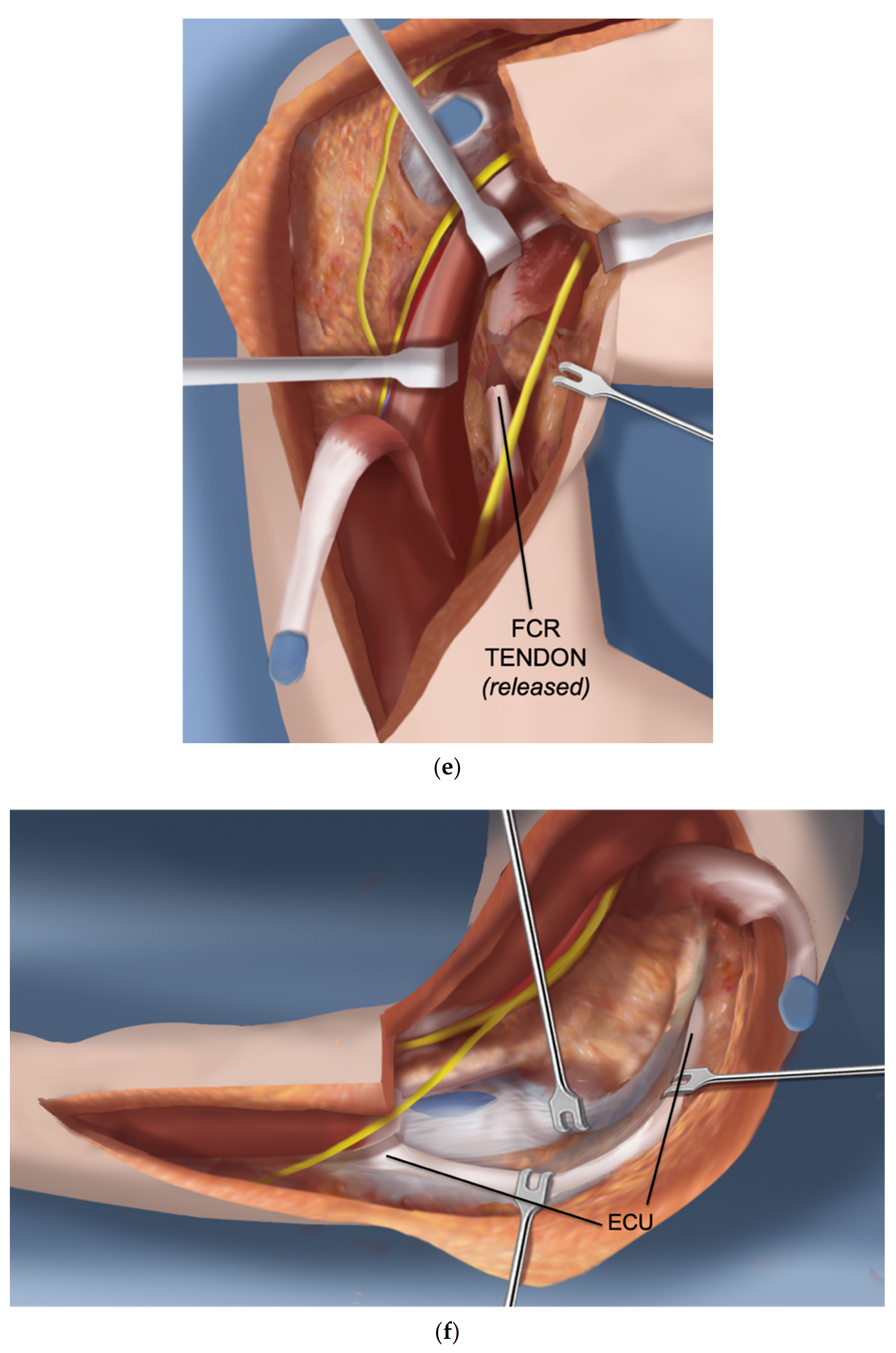 Children 08 00562 g001c