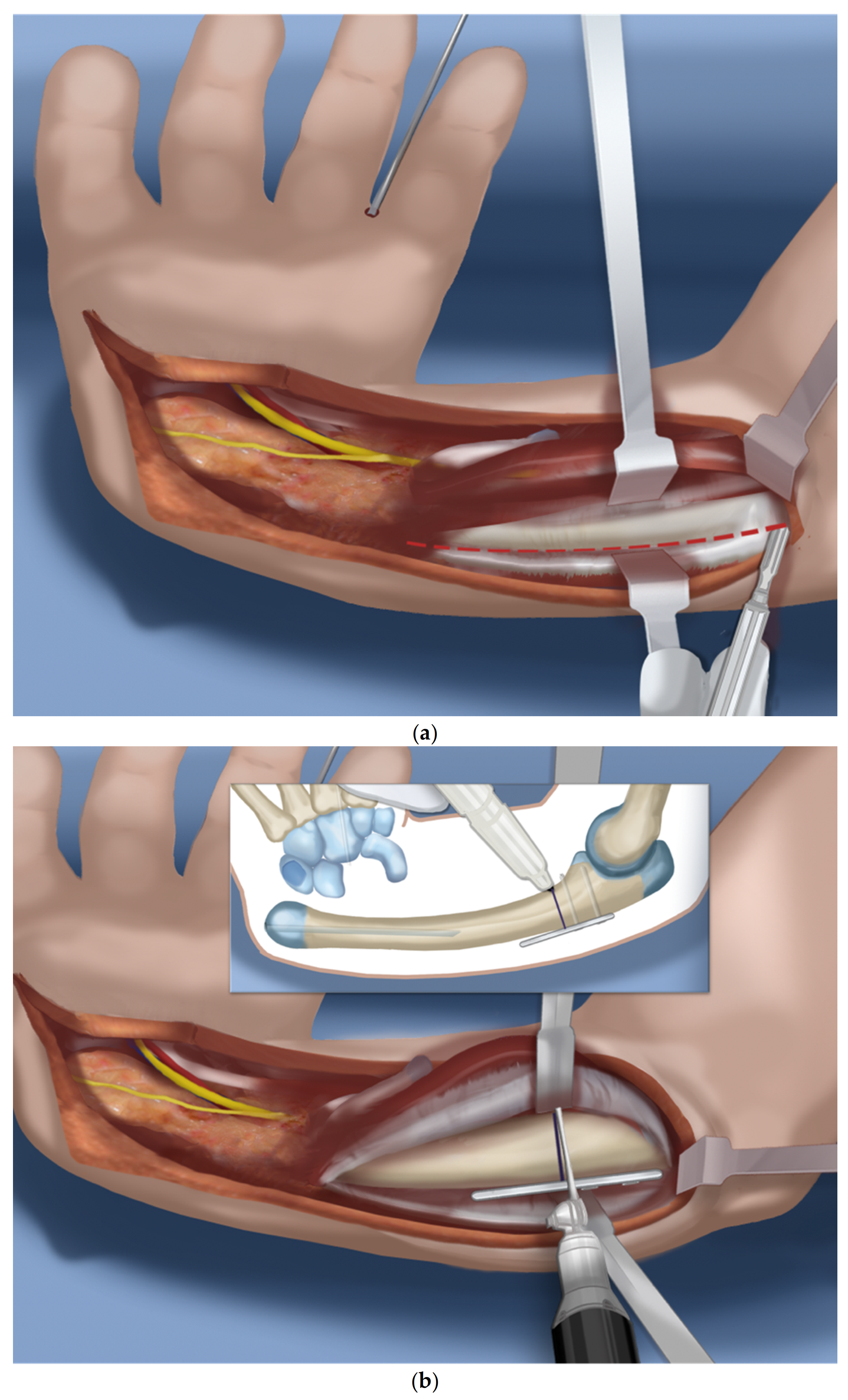 Children 08 00562 g002a