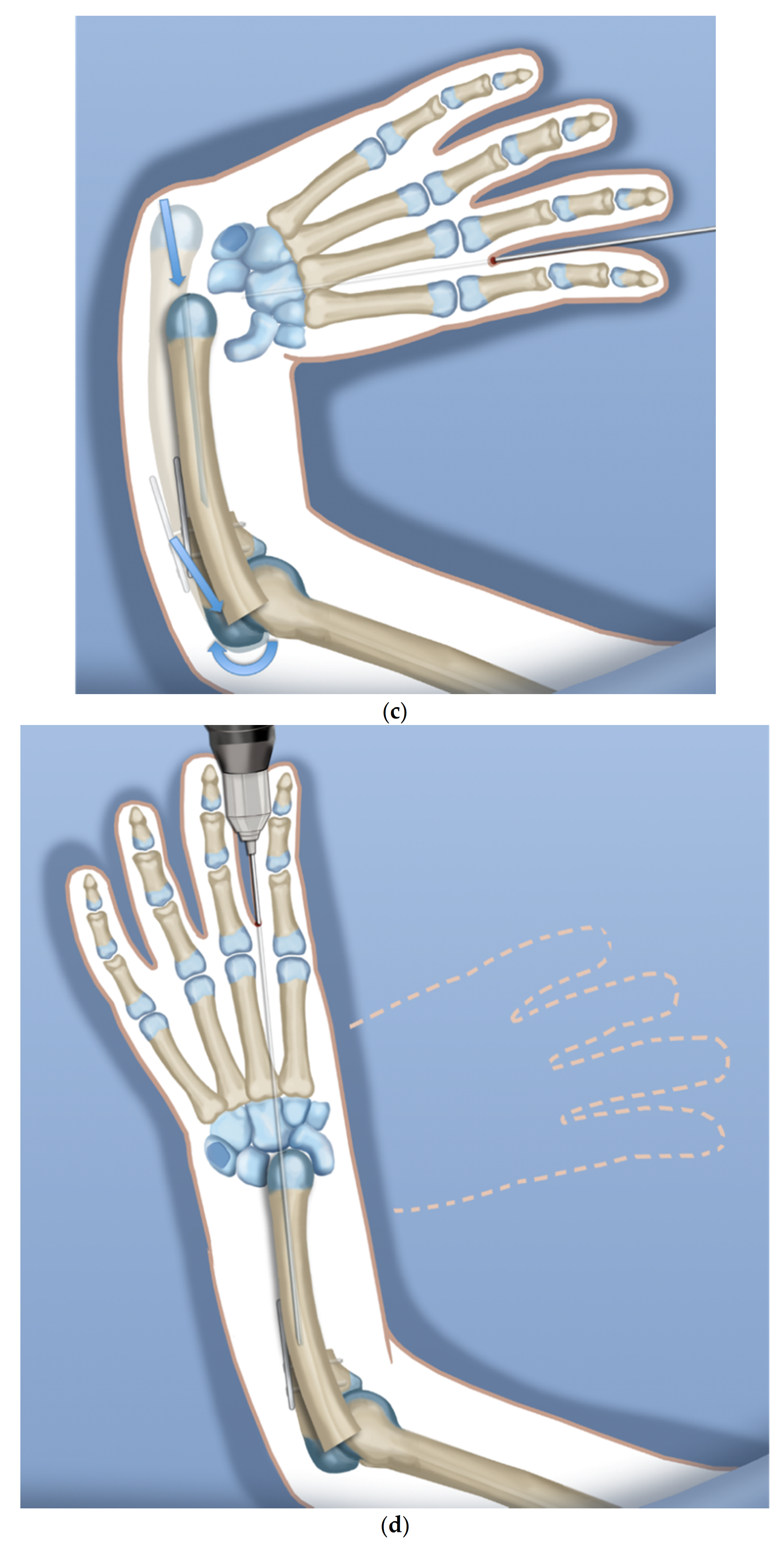 Children 08 00562 g002b