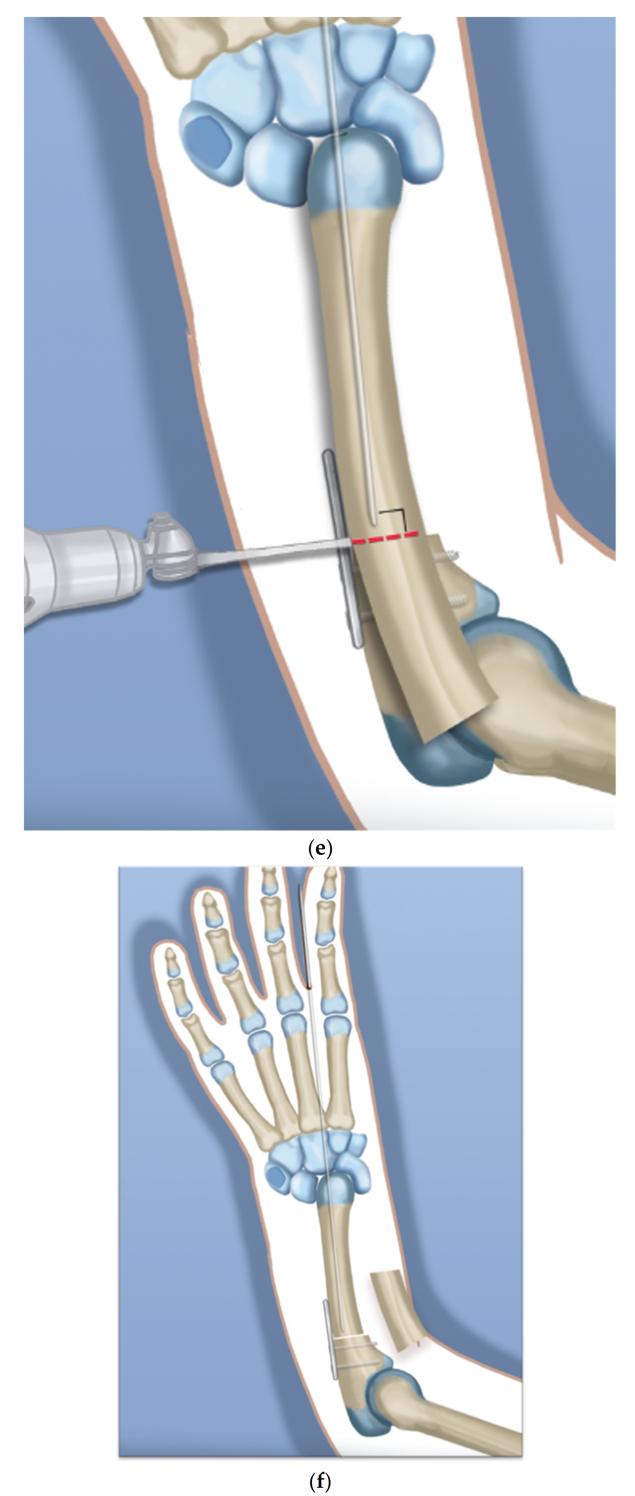 Children 08 00562 g002c