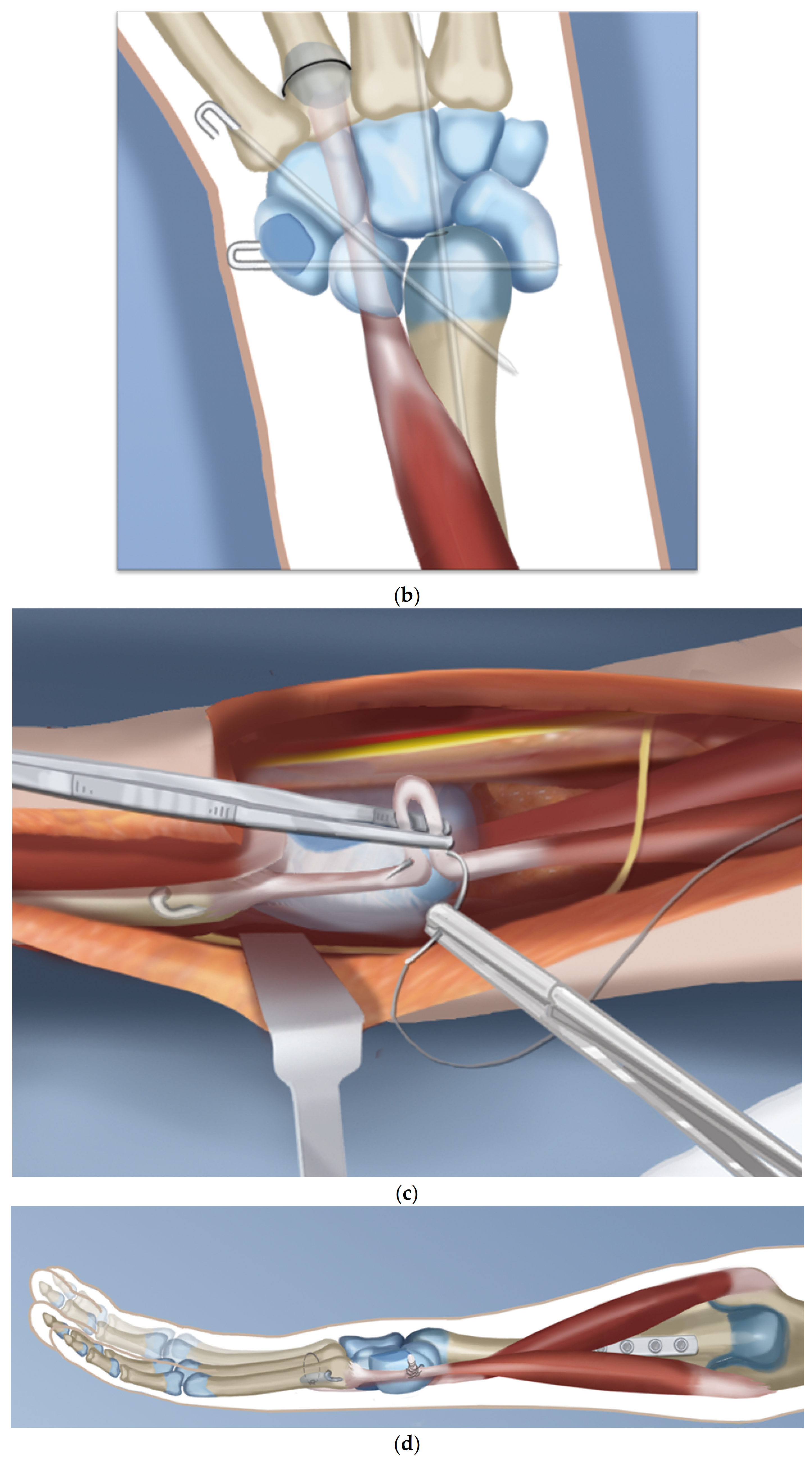 Children 08 00562 g003b