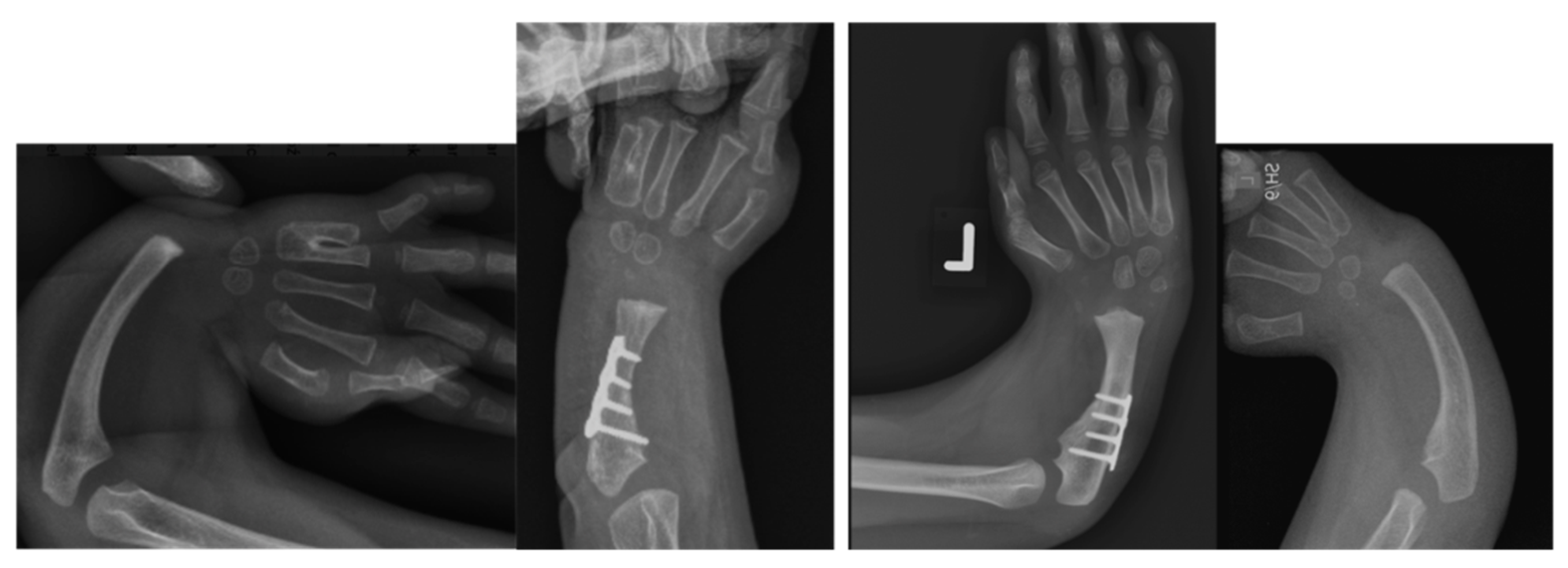 Children 08 00562 g004