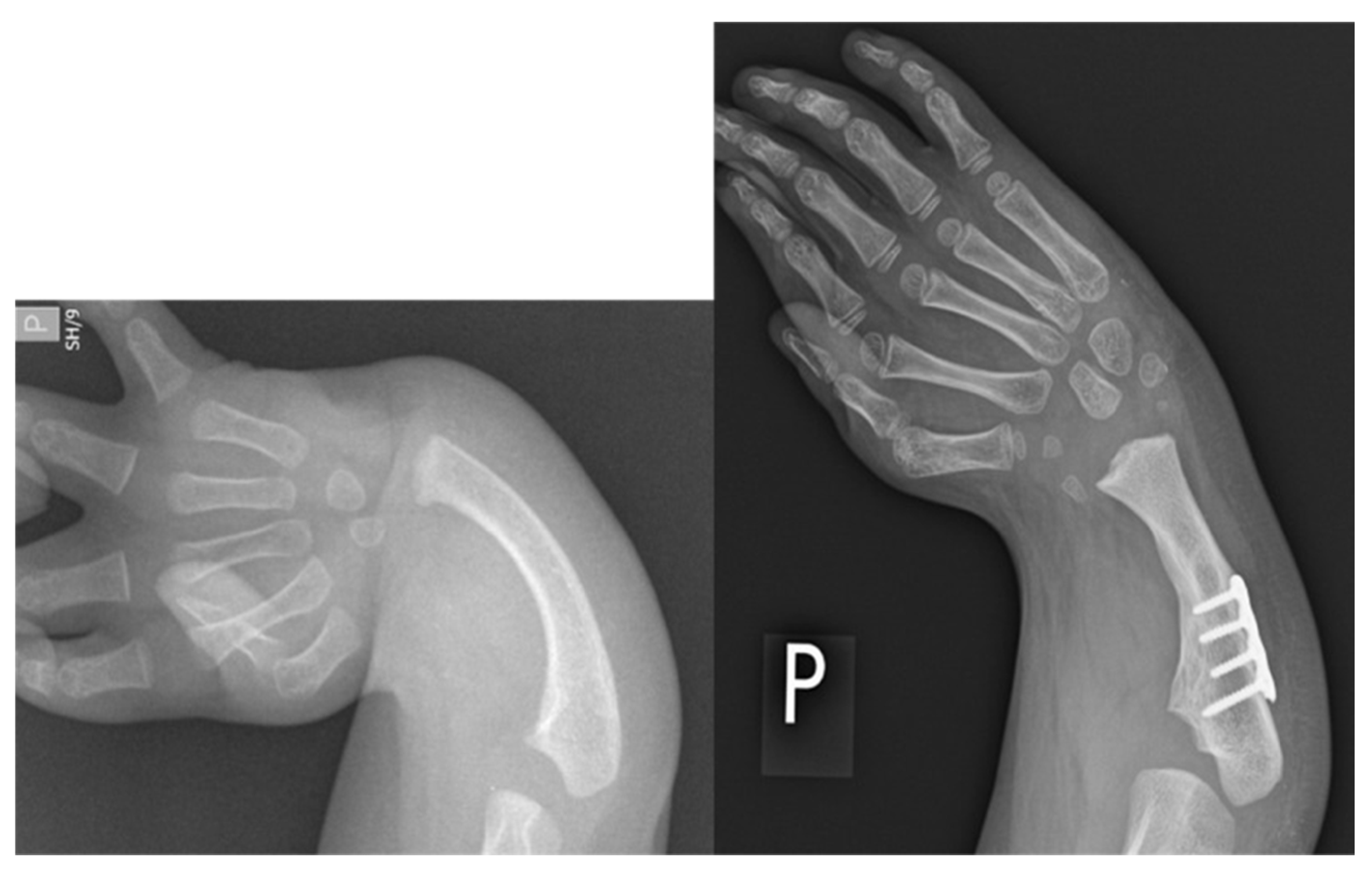 Children 08 00562 g005