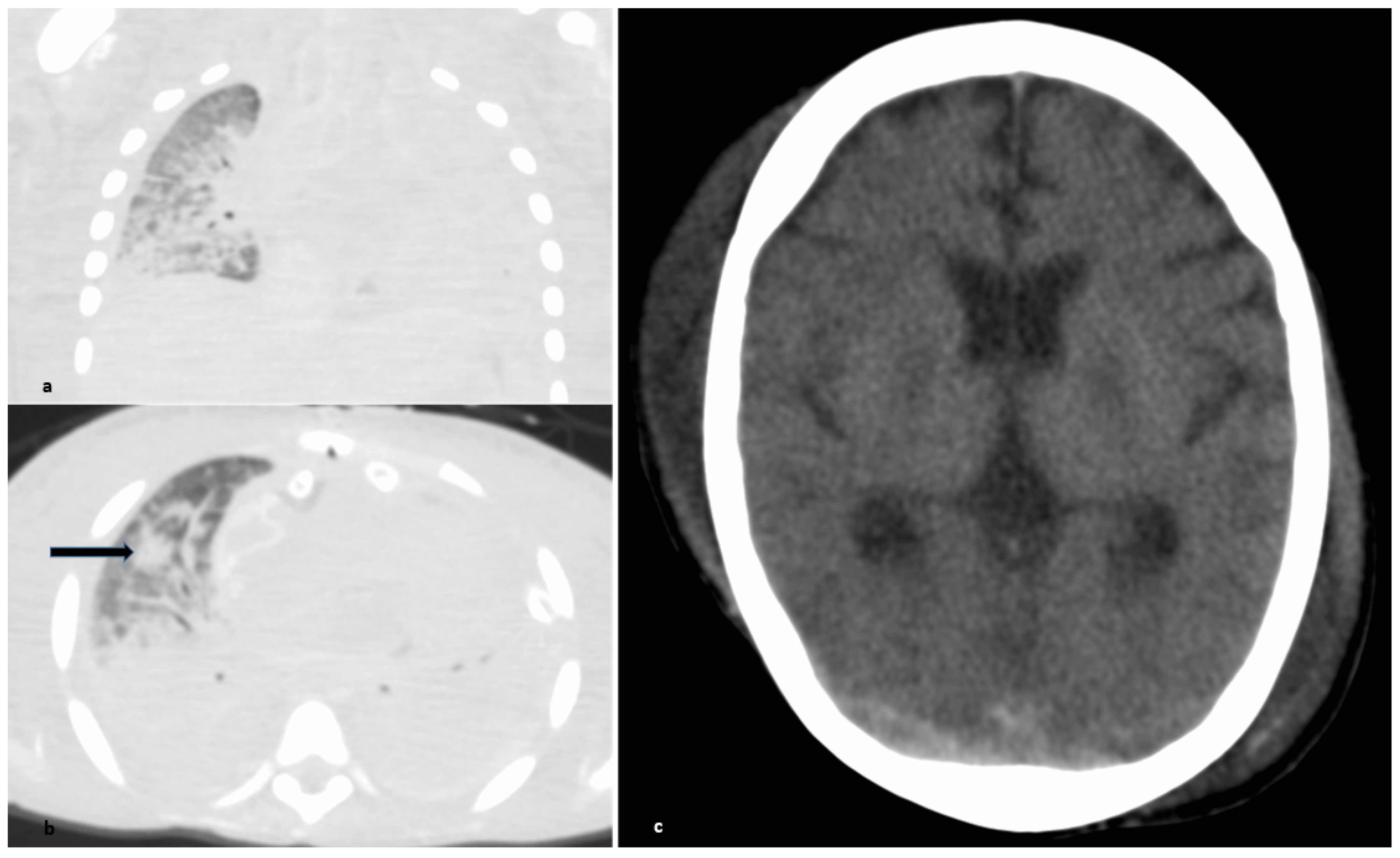 Children 08 00564 g002