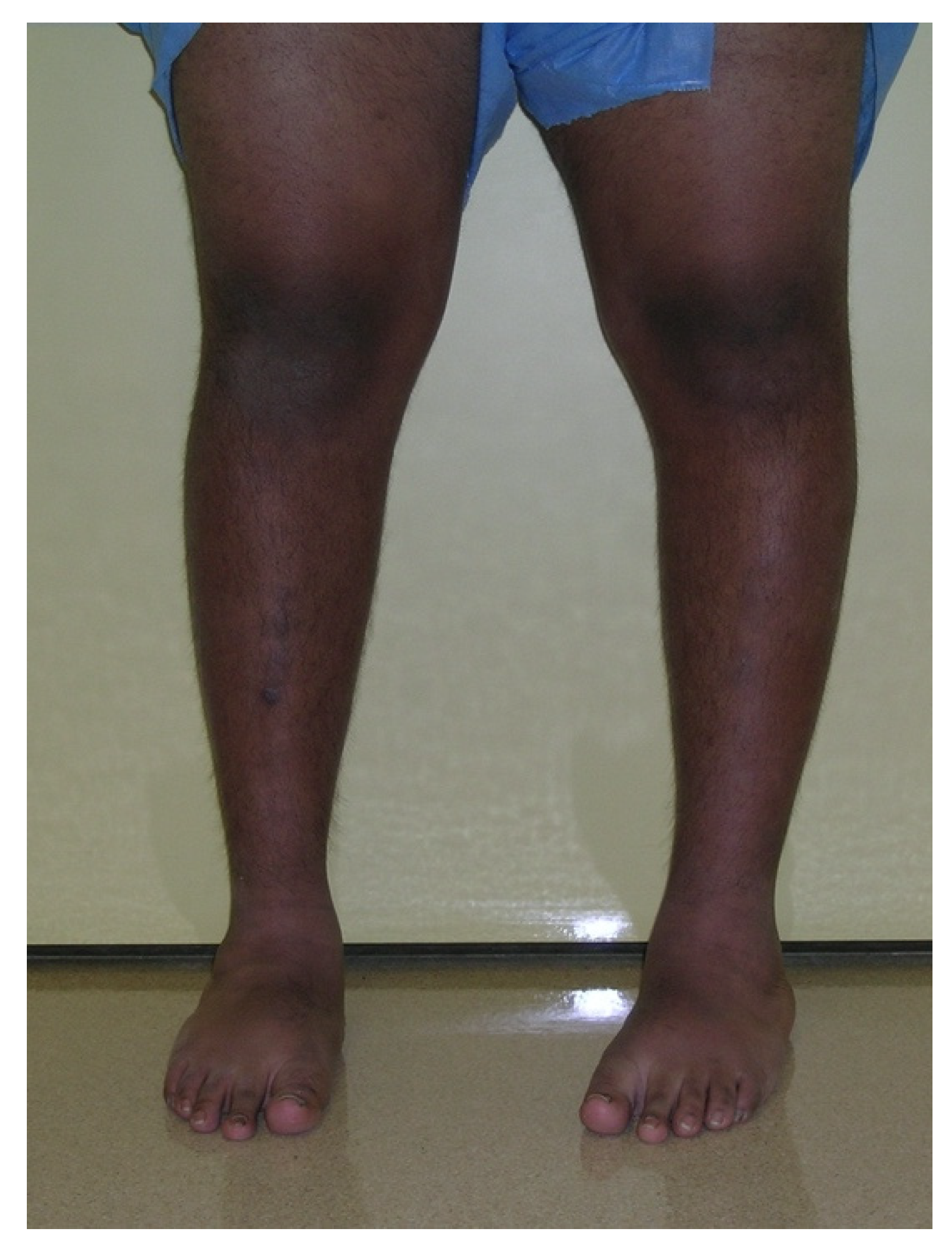 Children 08 00566 g002