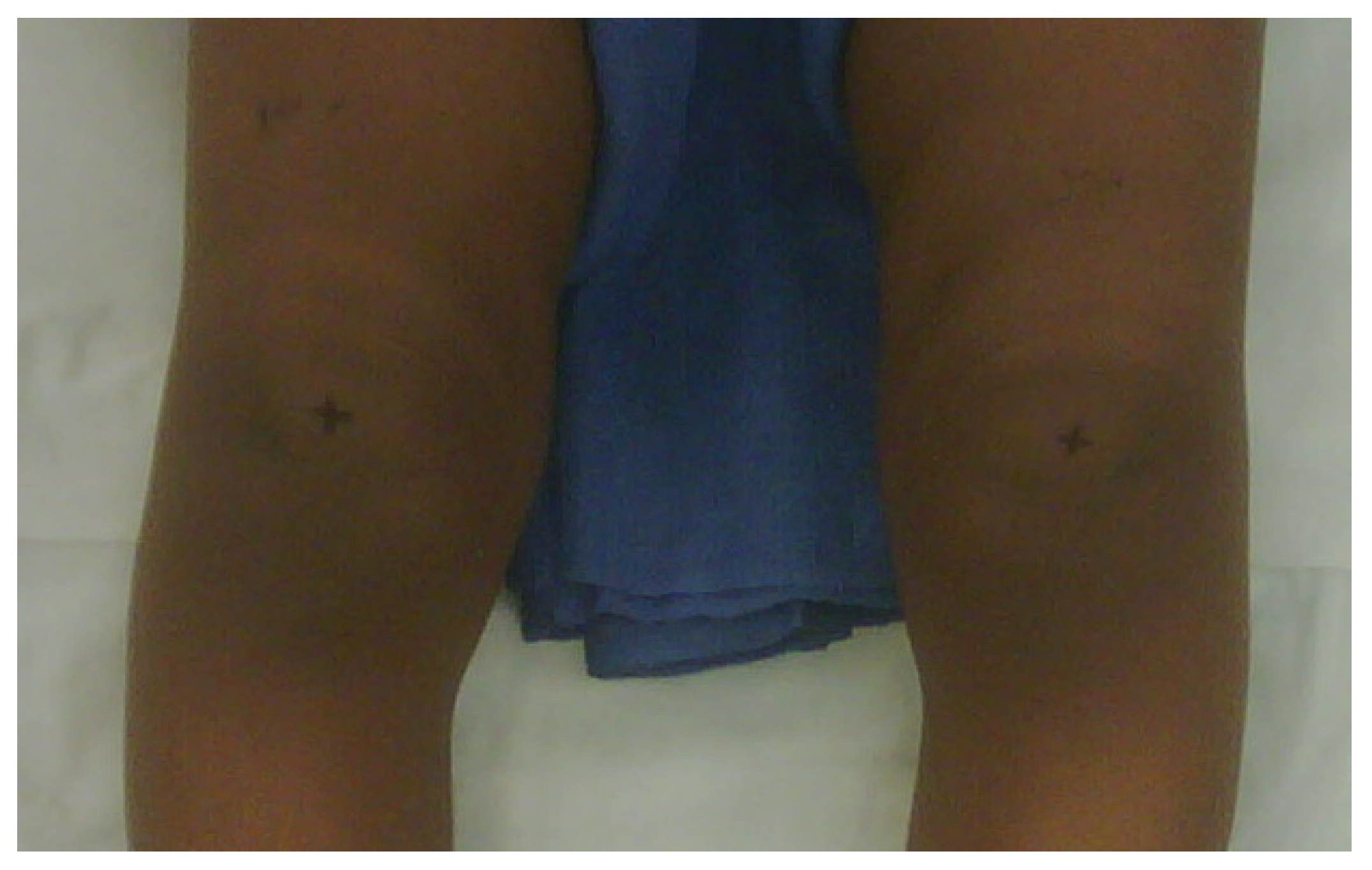 Children 08 00566 g003