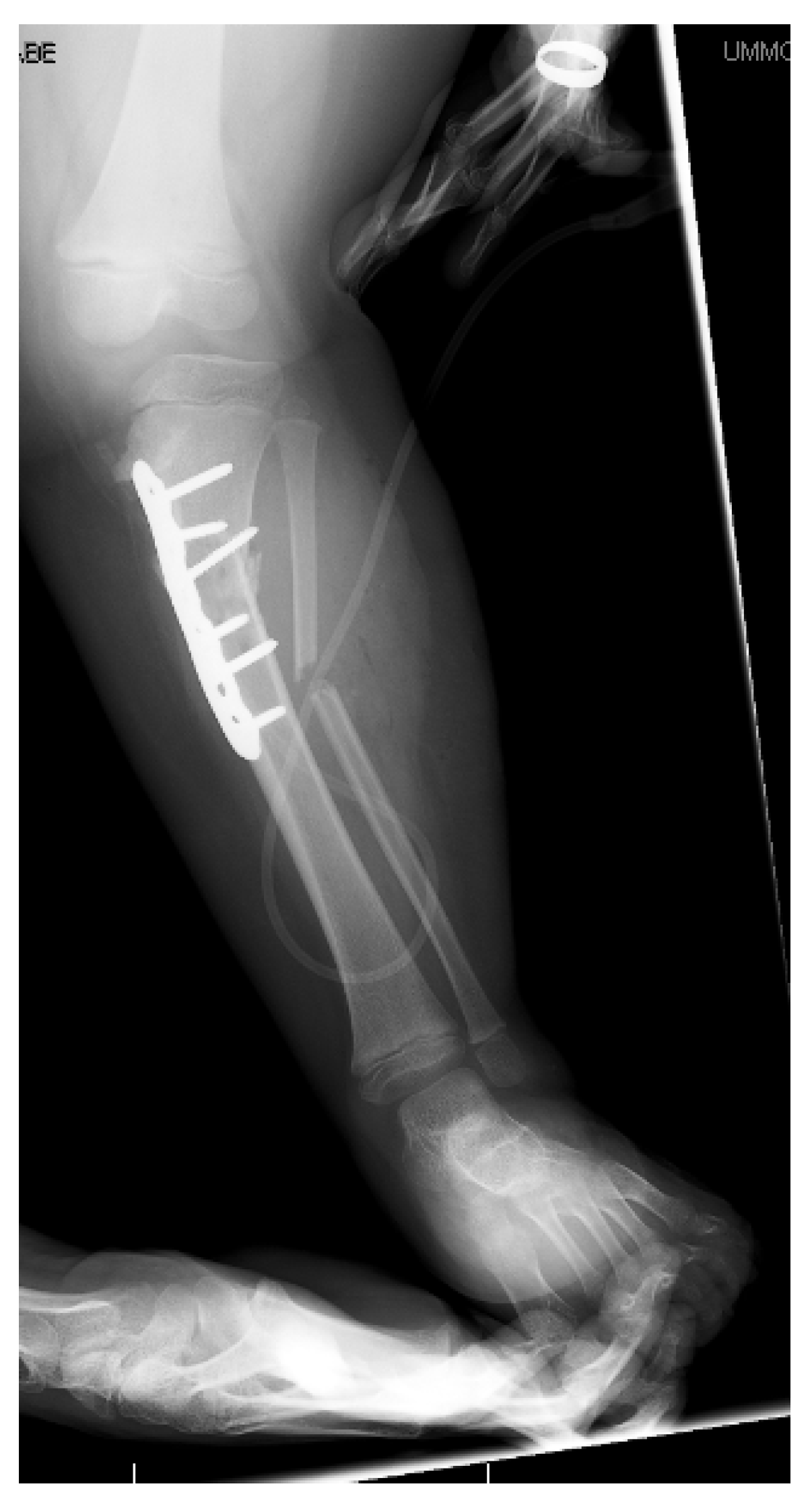 Children 08 00566 g014