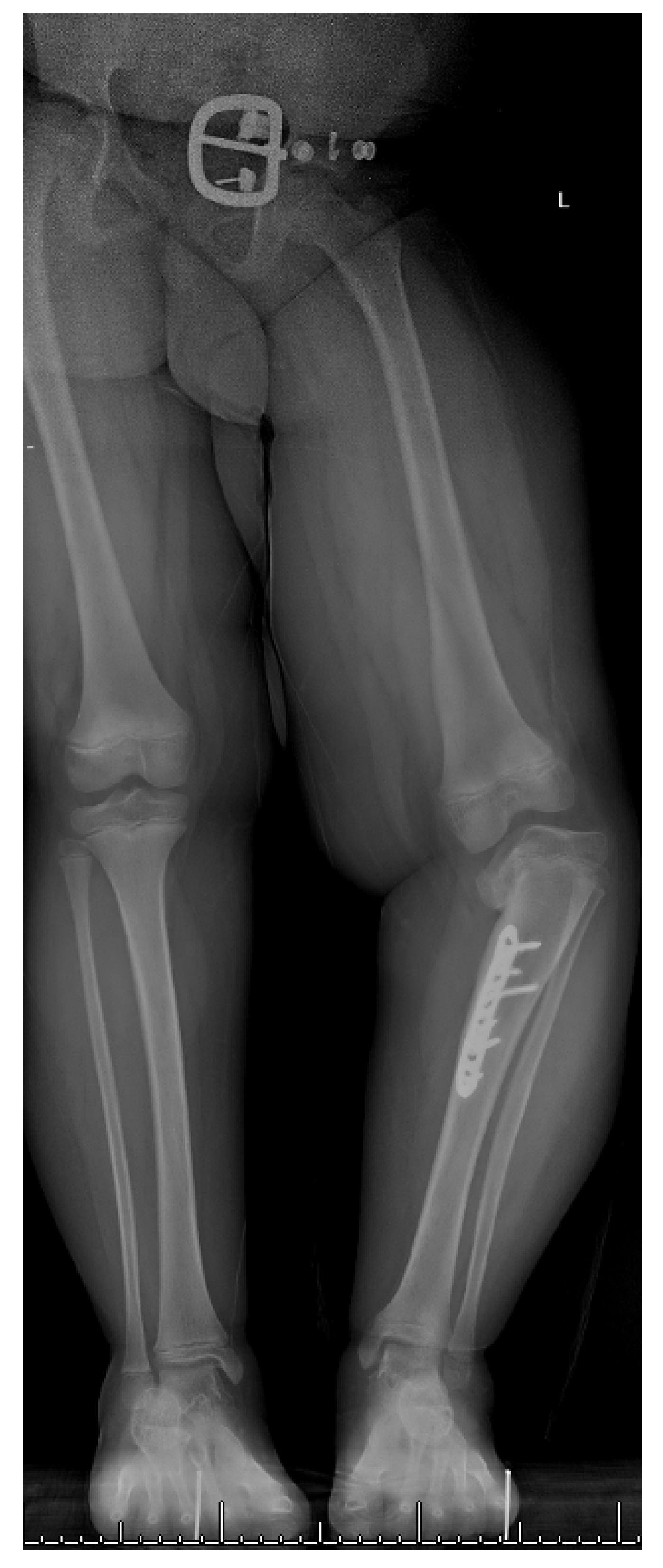 Children 08 00566 g015