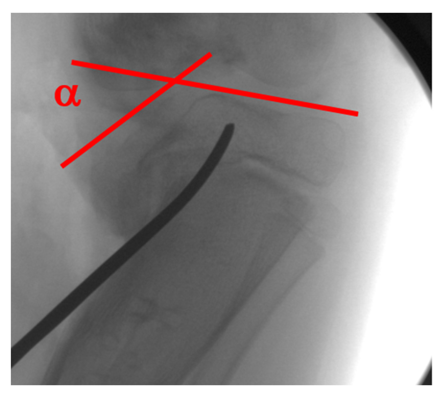 Children 08 00566 g016