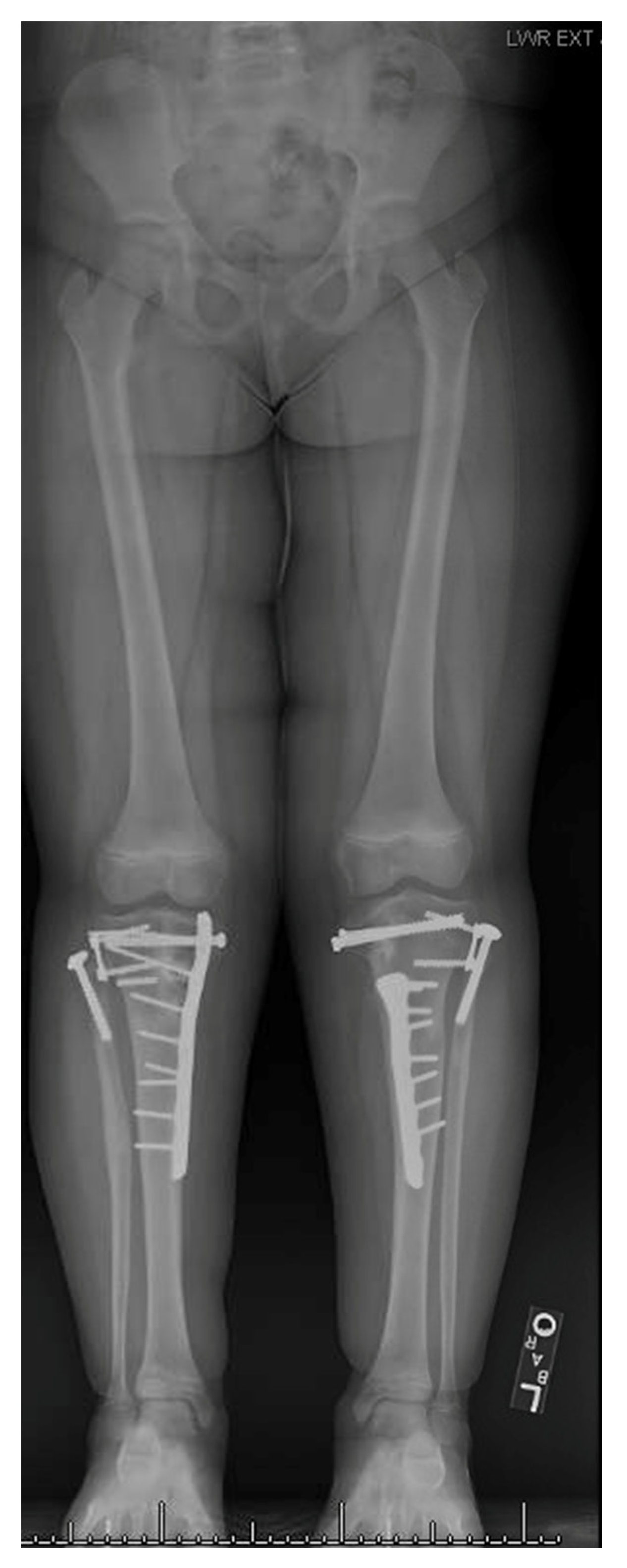 Children 08 00566 g019