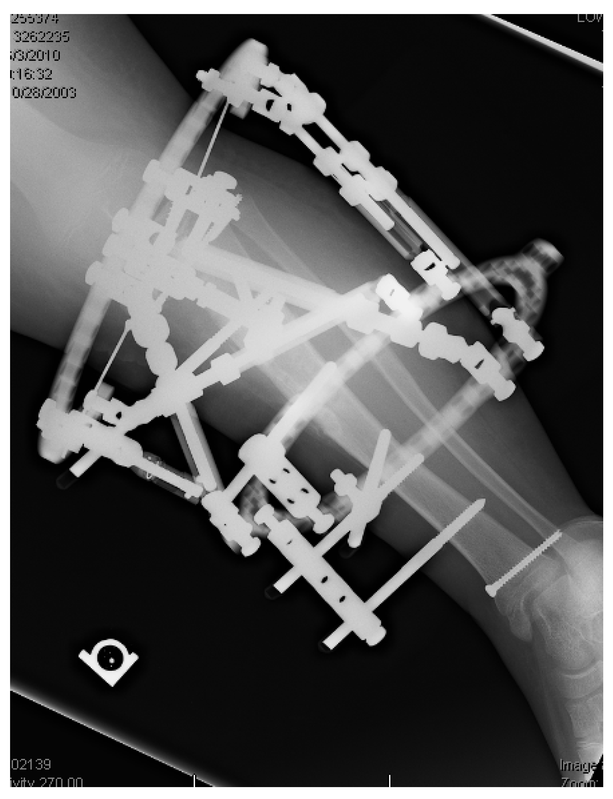 Children 08 00566 g020