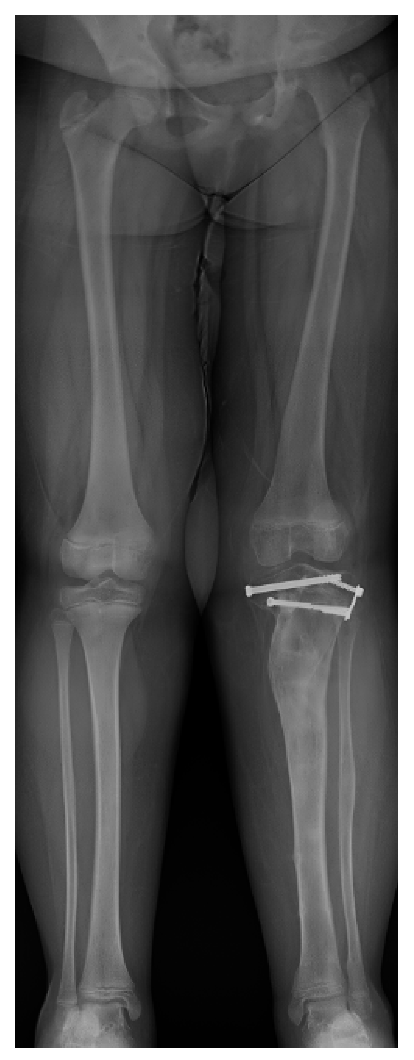 Children 08 00566 g021