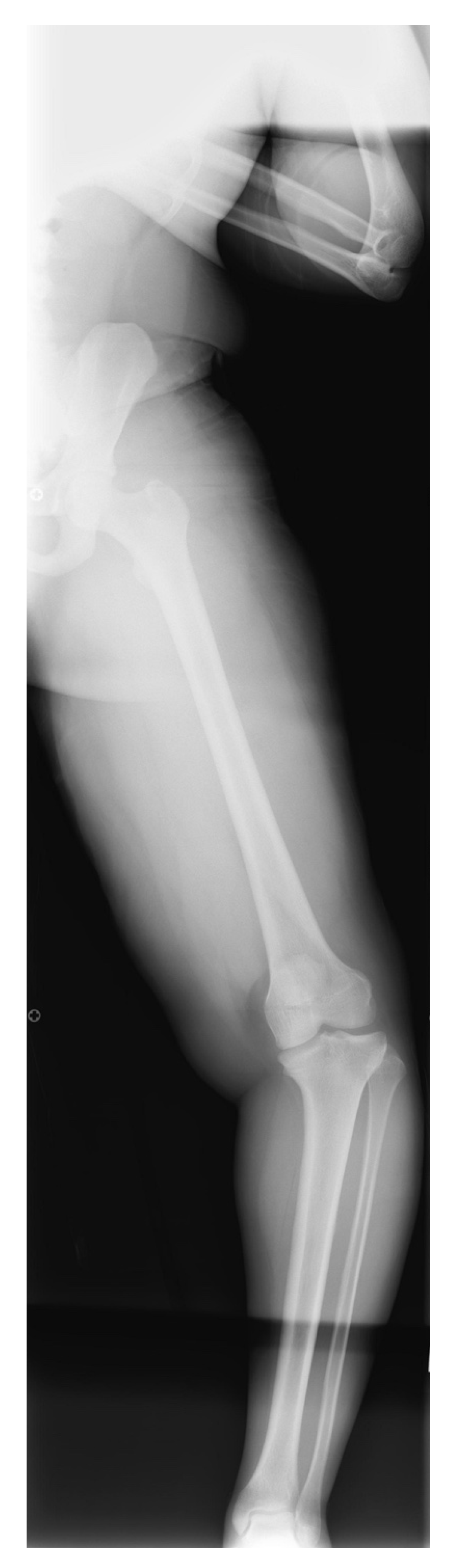 Children 08 00566 g022