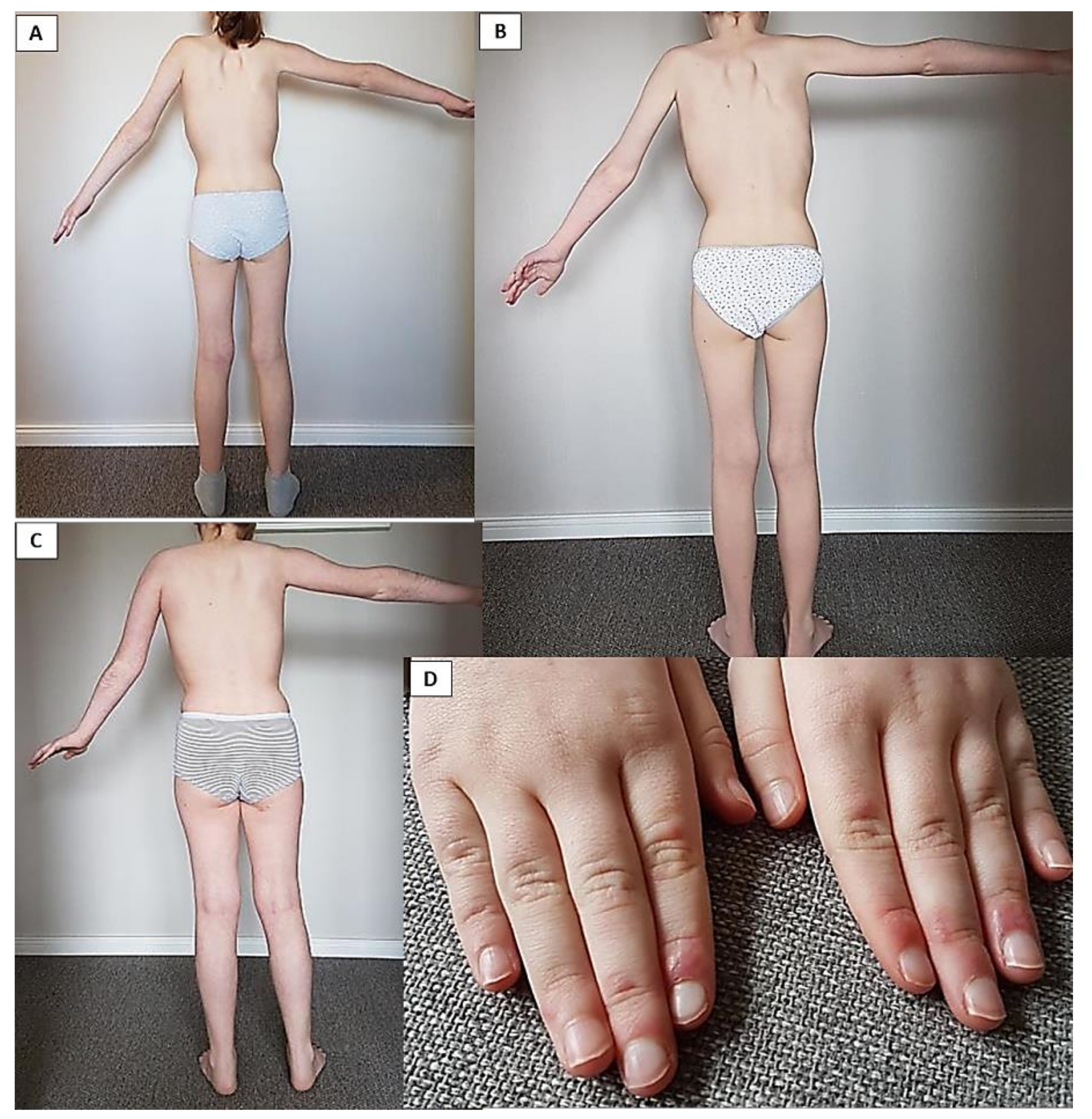 Children 08 00721 g002