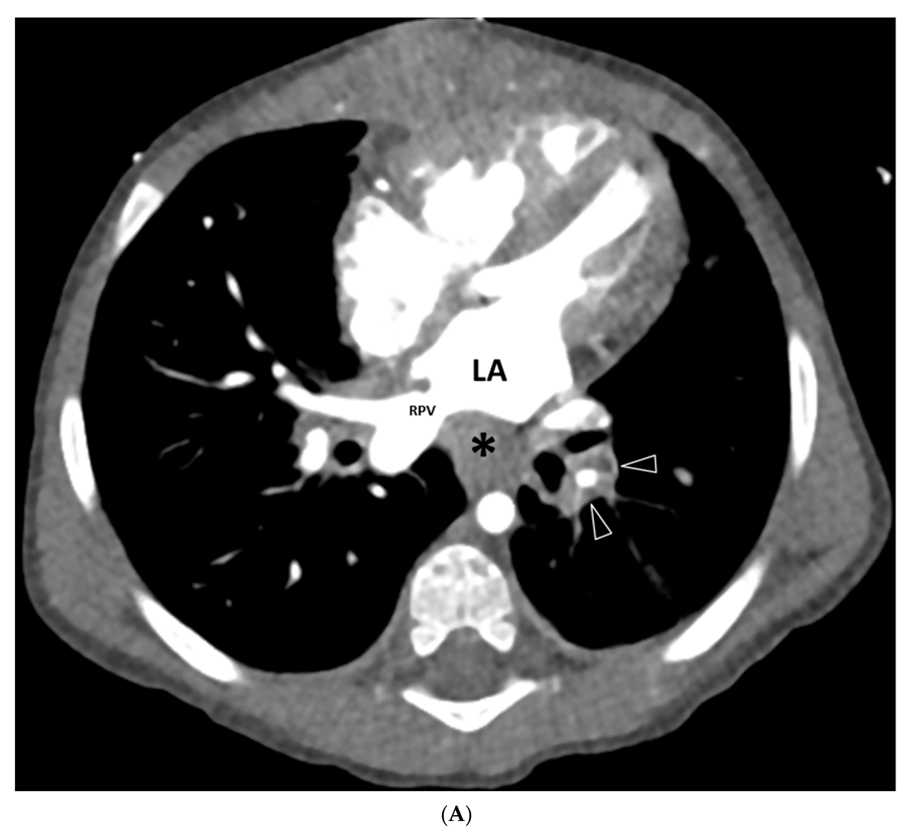 Children 08 00726 g002a