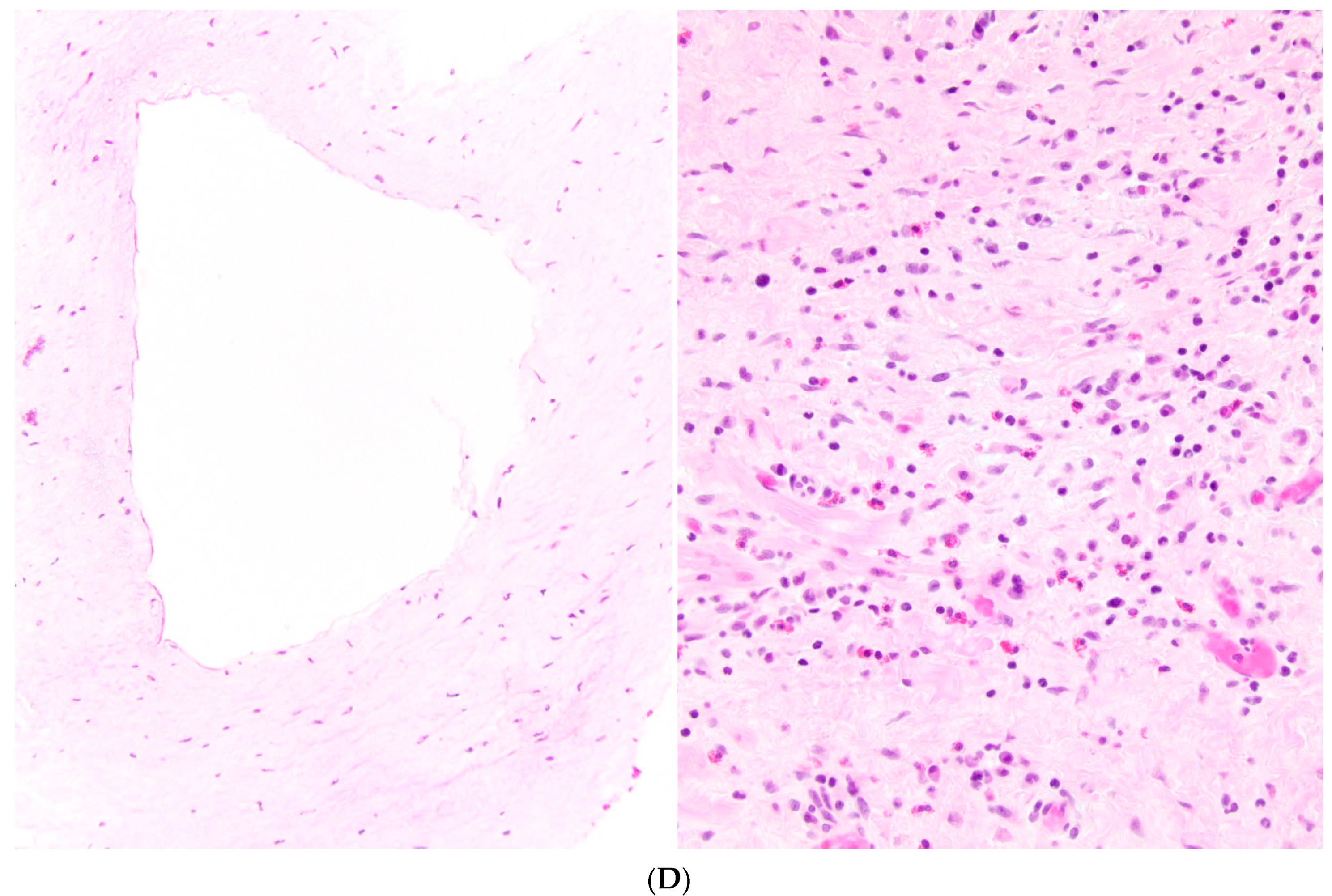 Children 08 00726 g002c