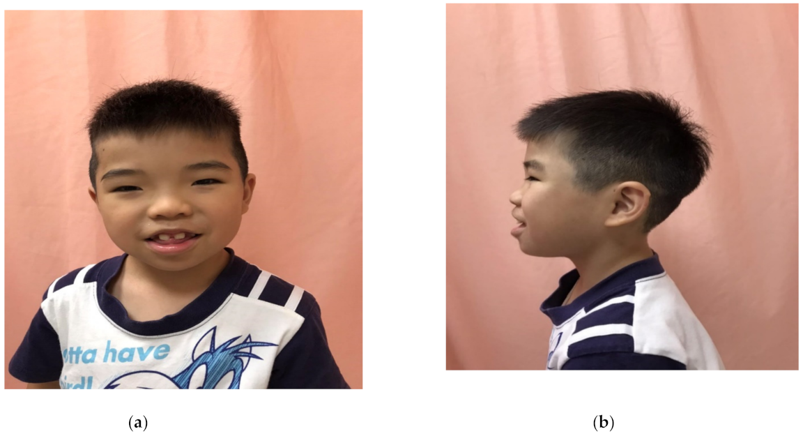 Children 08 00952 g001