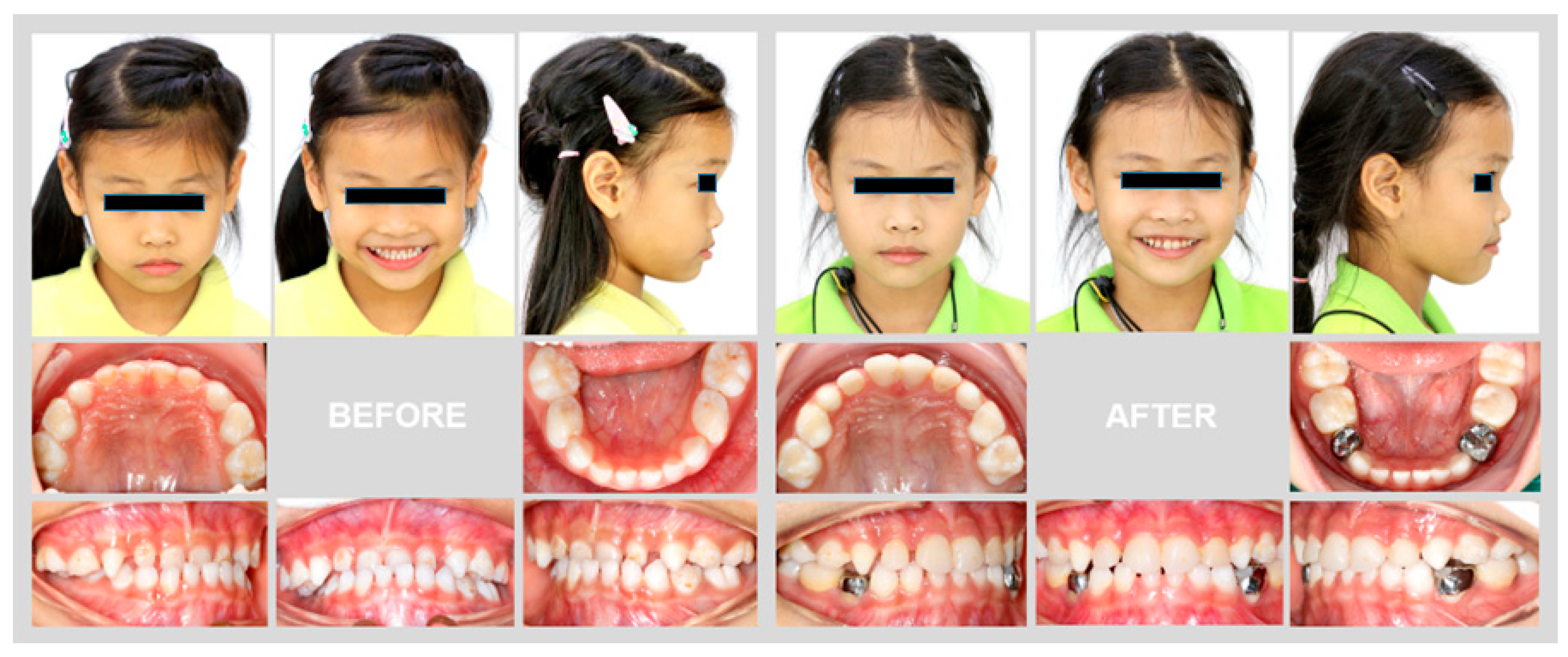 Children 08 00957 g003