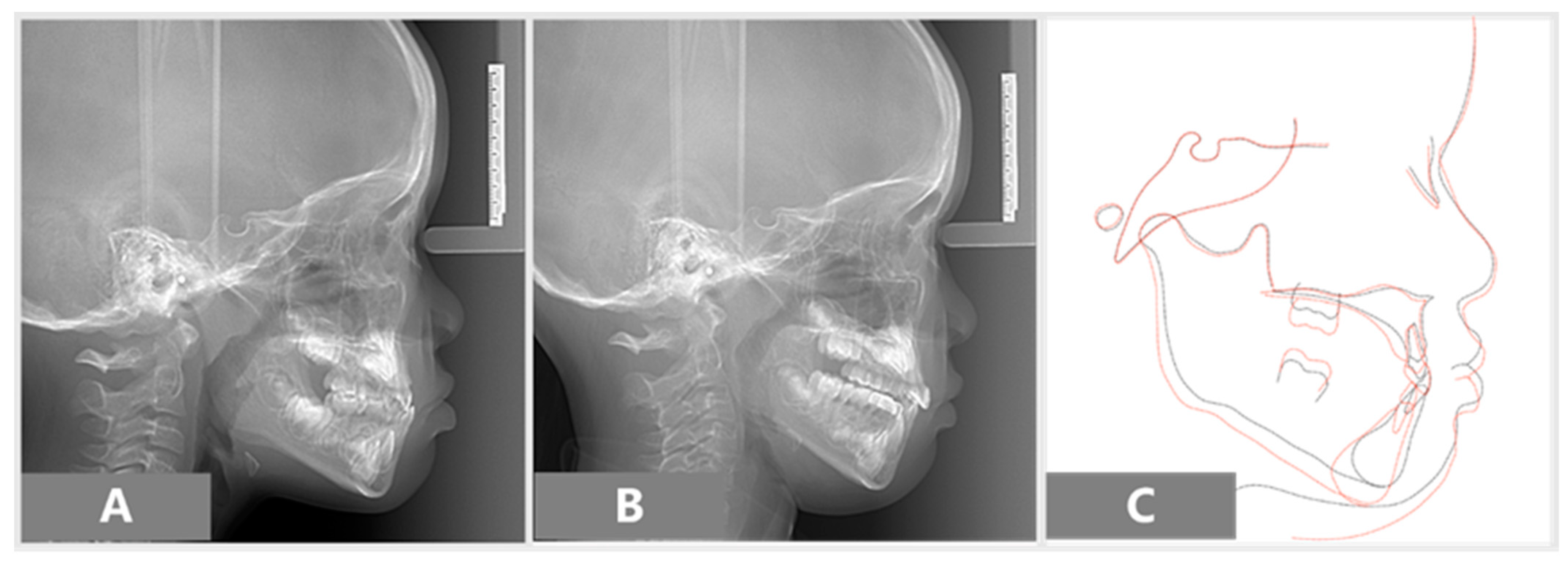 Children 08 00957 g005