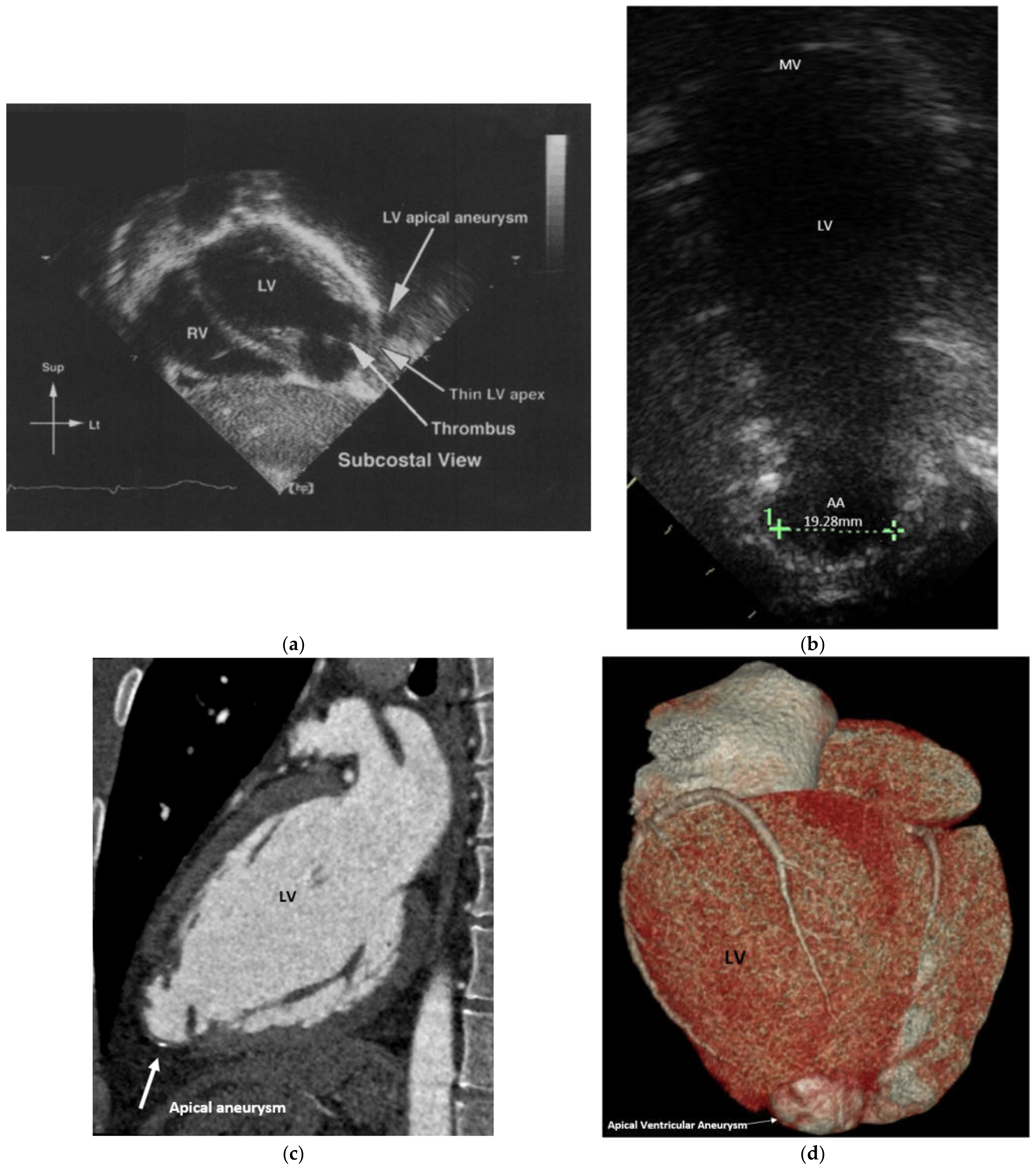 Children 08 00981 g001