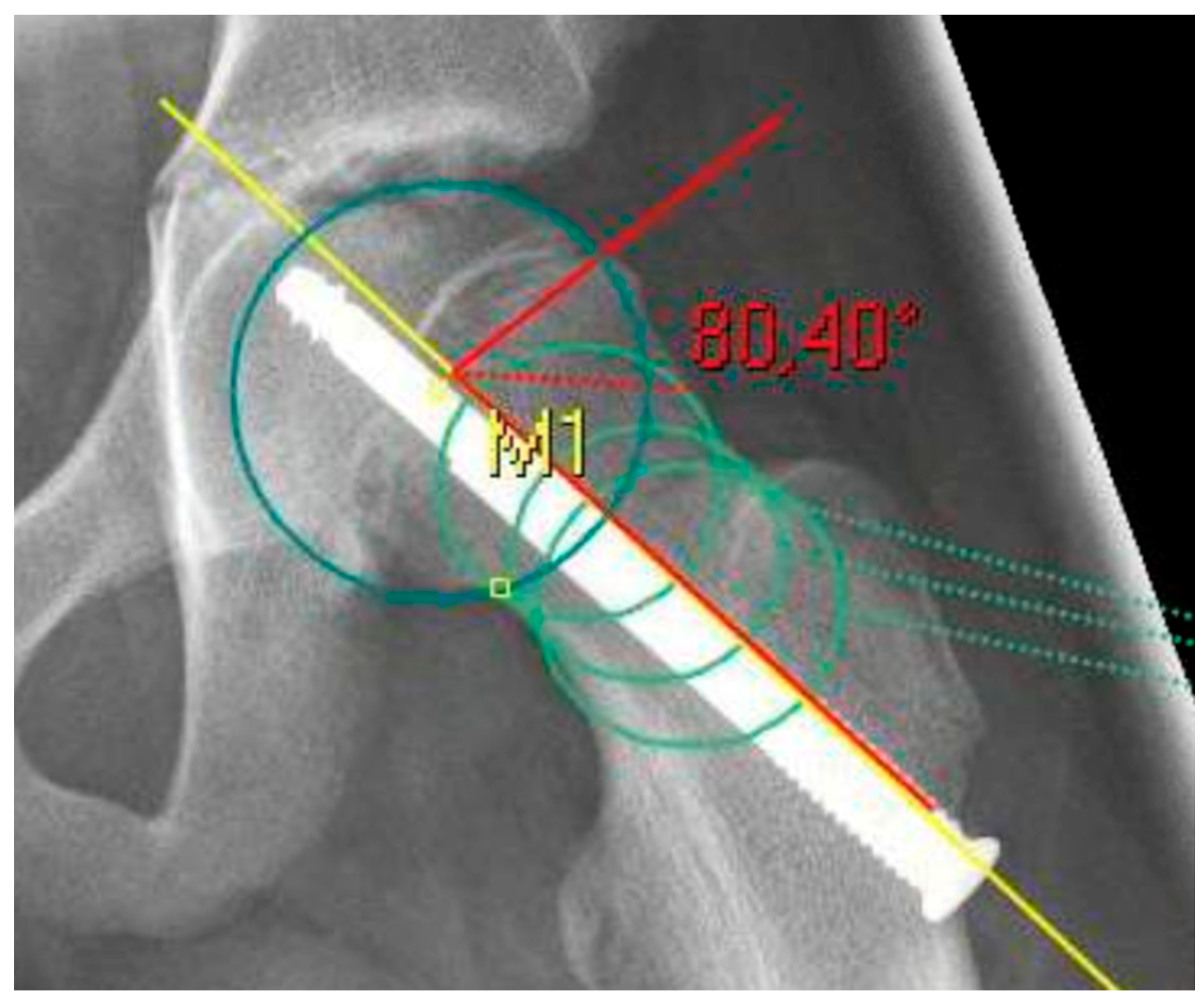 Children 08 00992 g001