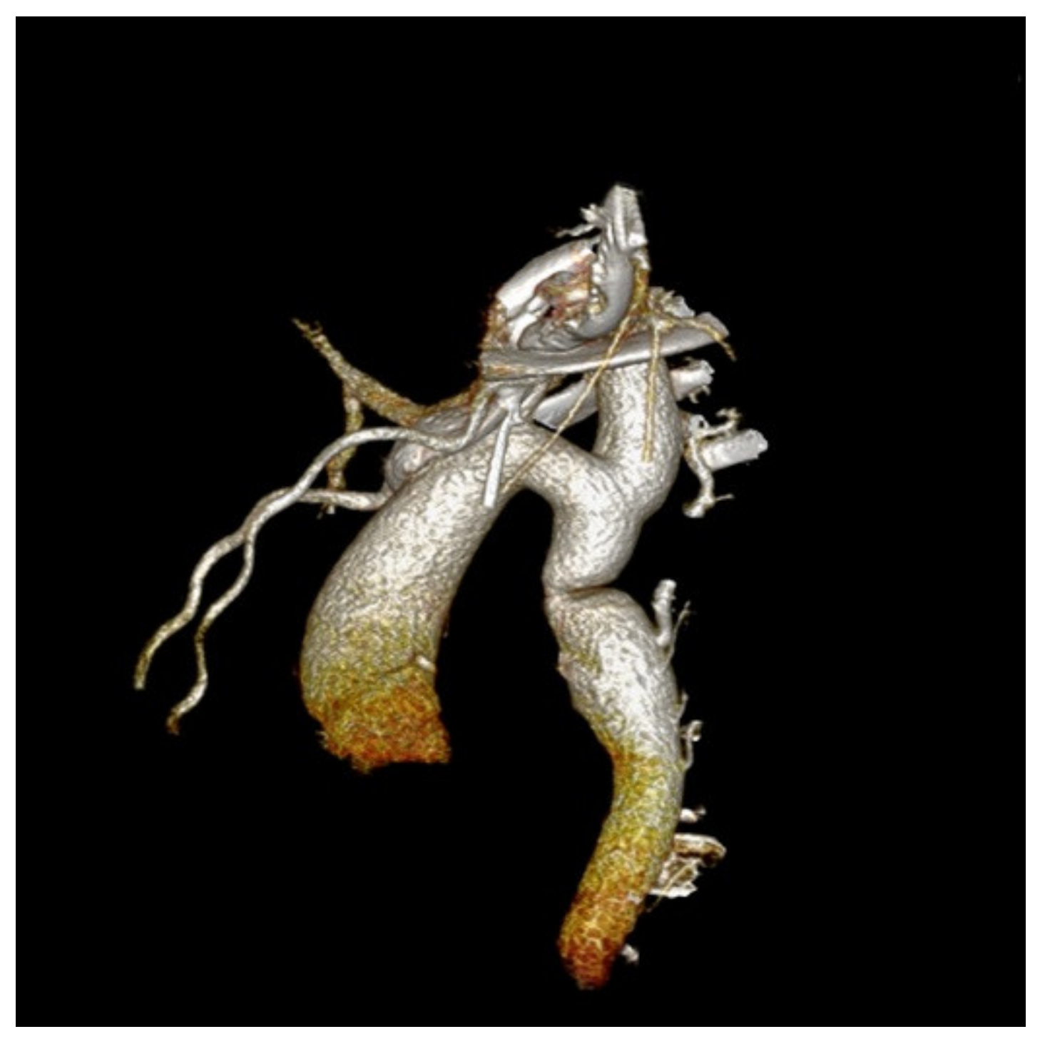 Children 08 01018 g003