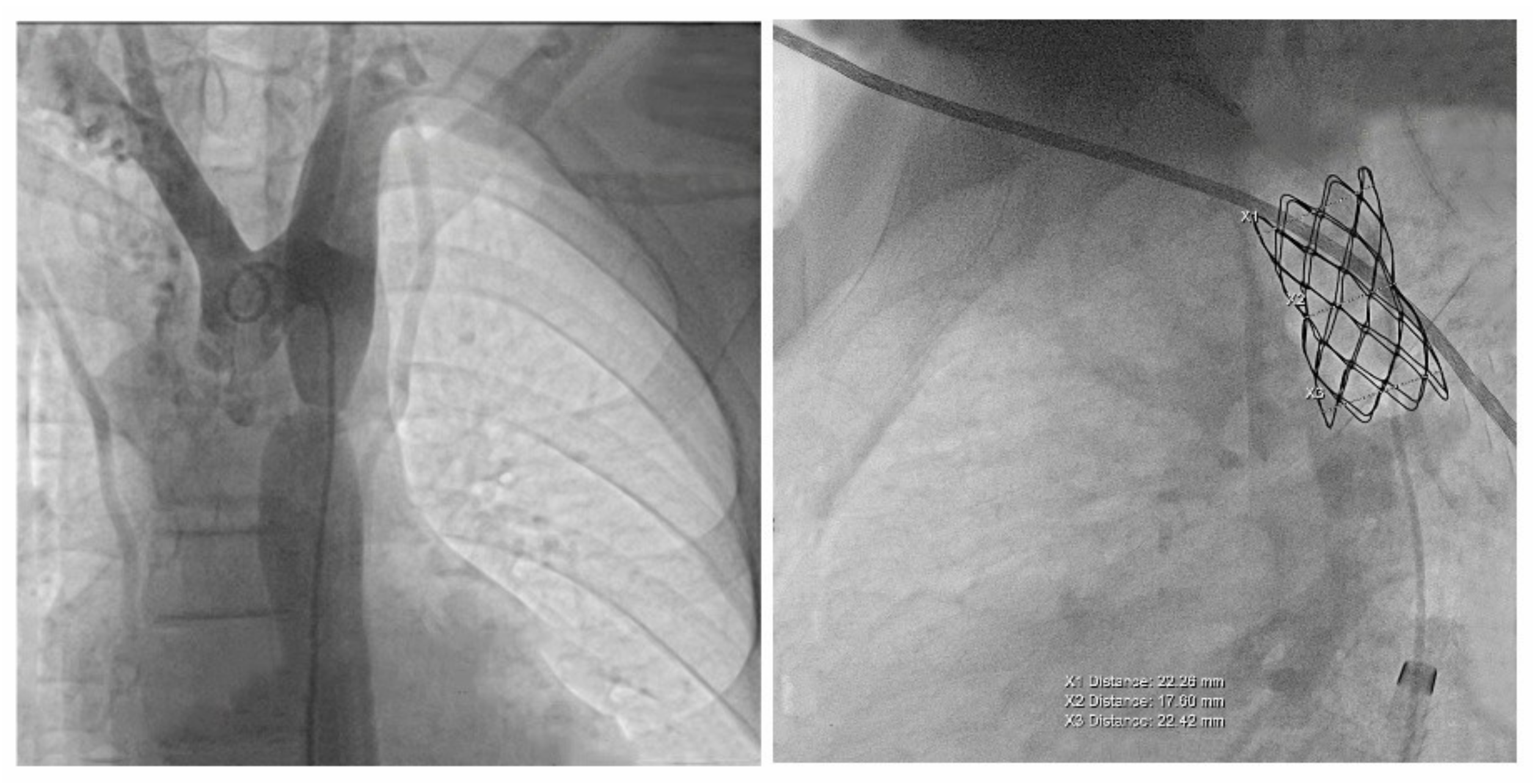 Children 08 01018 g004