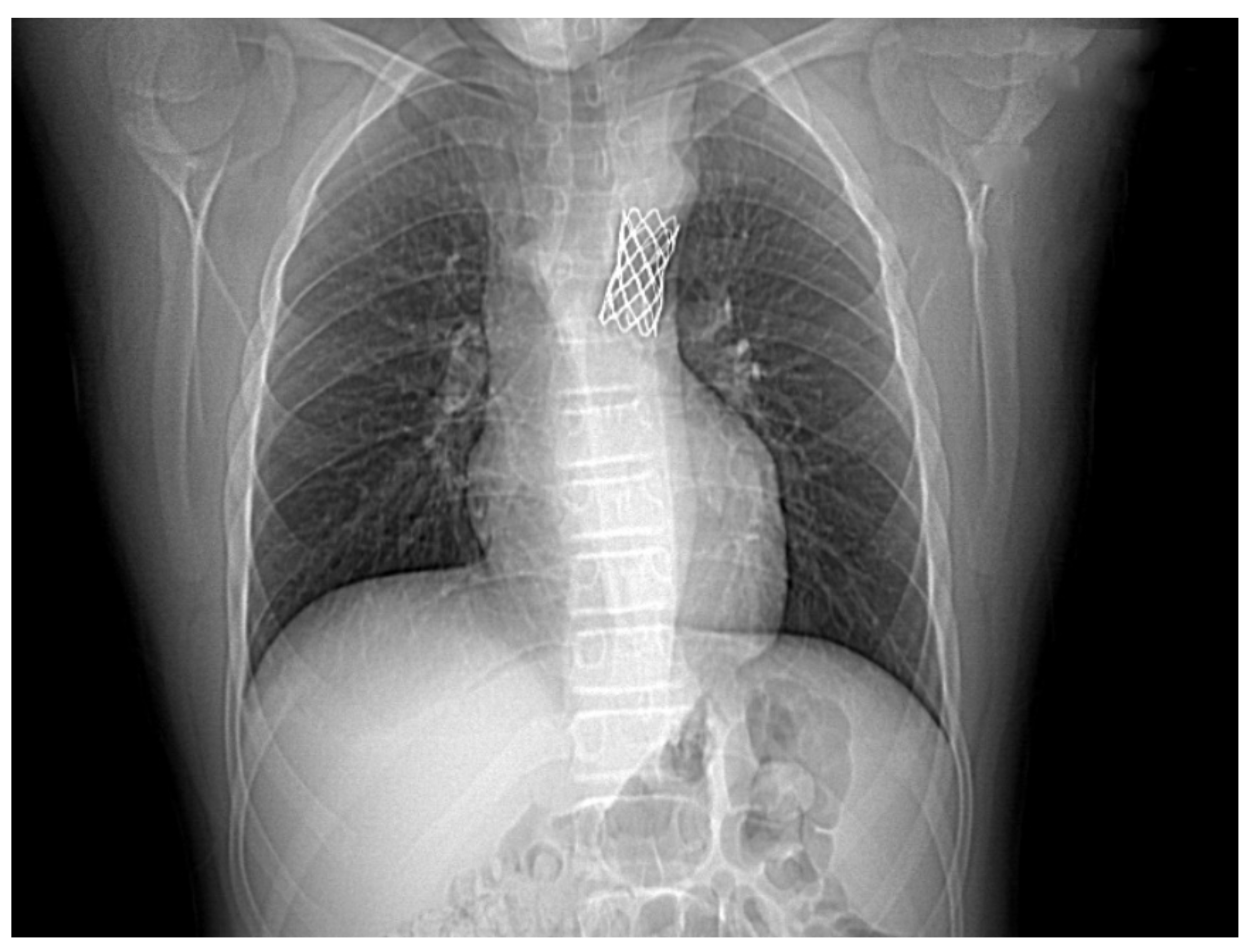 Children 08 01018 g005