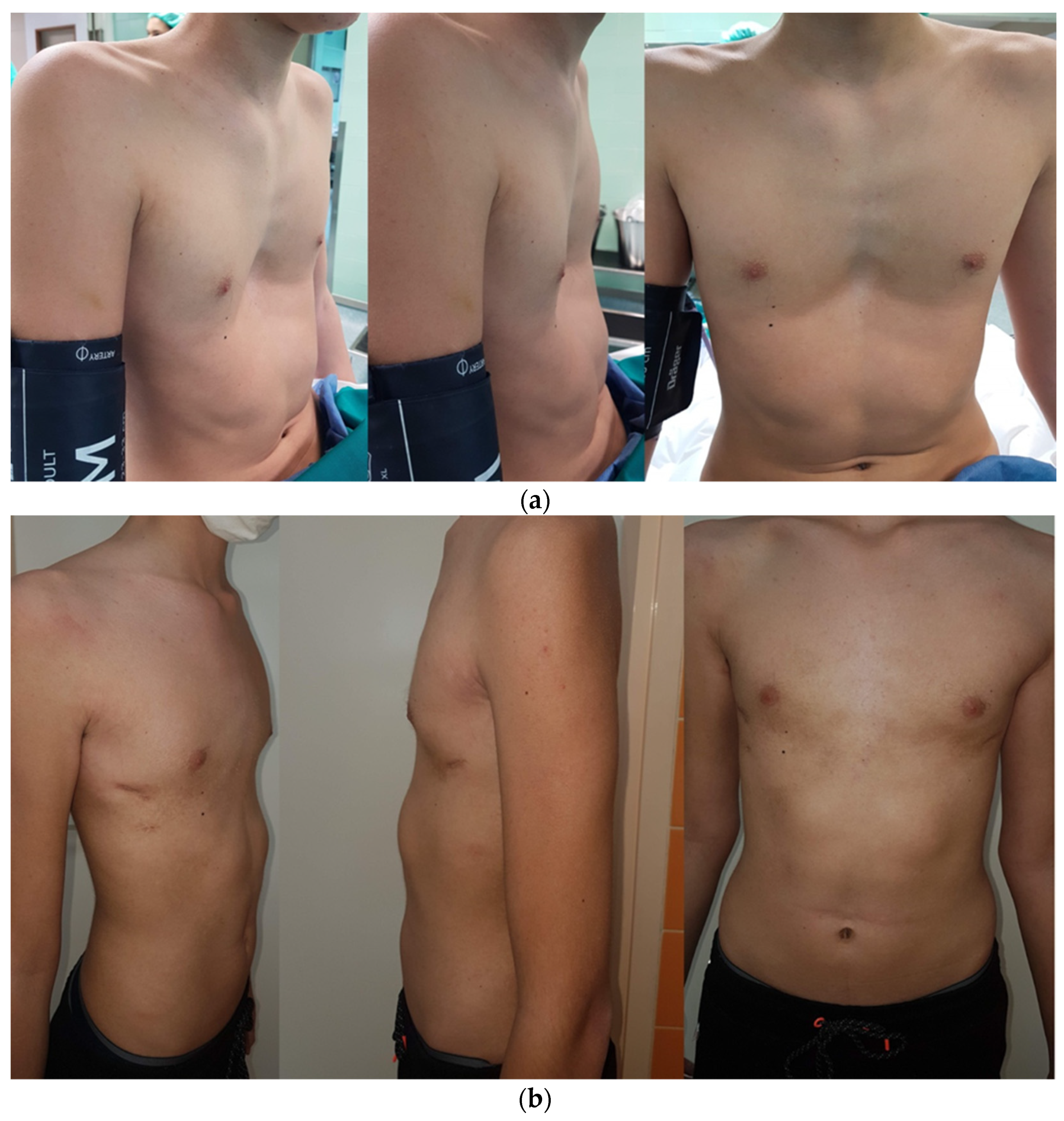 Children 08 01071 g001